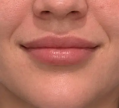 Educational lip anatomy assessment illustration