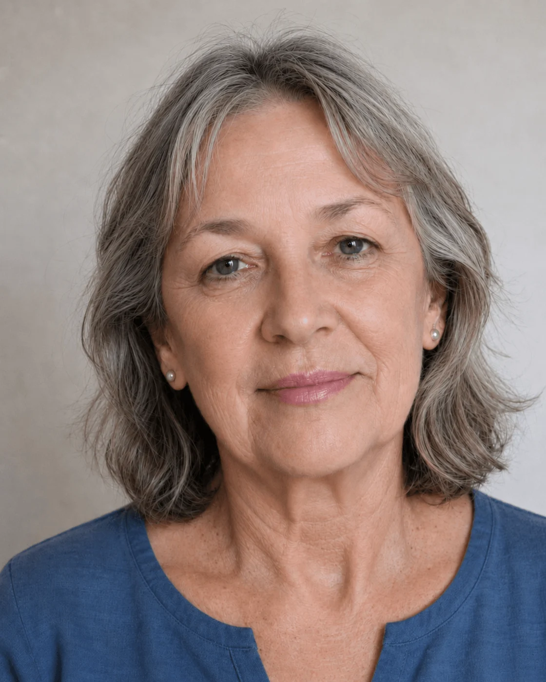 Lip and perioral consultation assessment for consultation planning at Core Aesthetics in Oakleigh