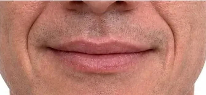 Male lip and perioral reference used for lip assessment discussion at Core Aesthetics