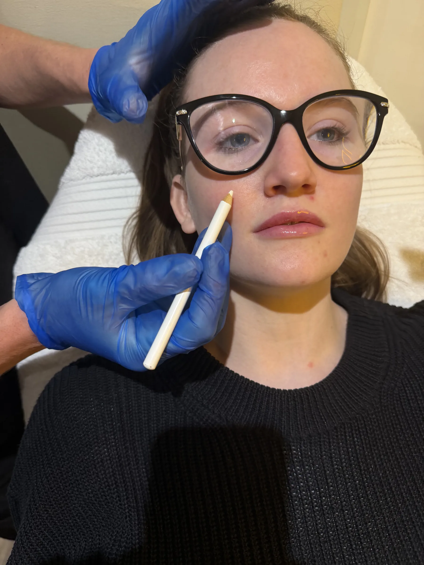Staff model during under-eye and tear trough assessment