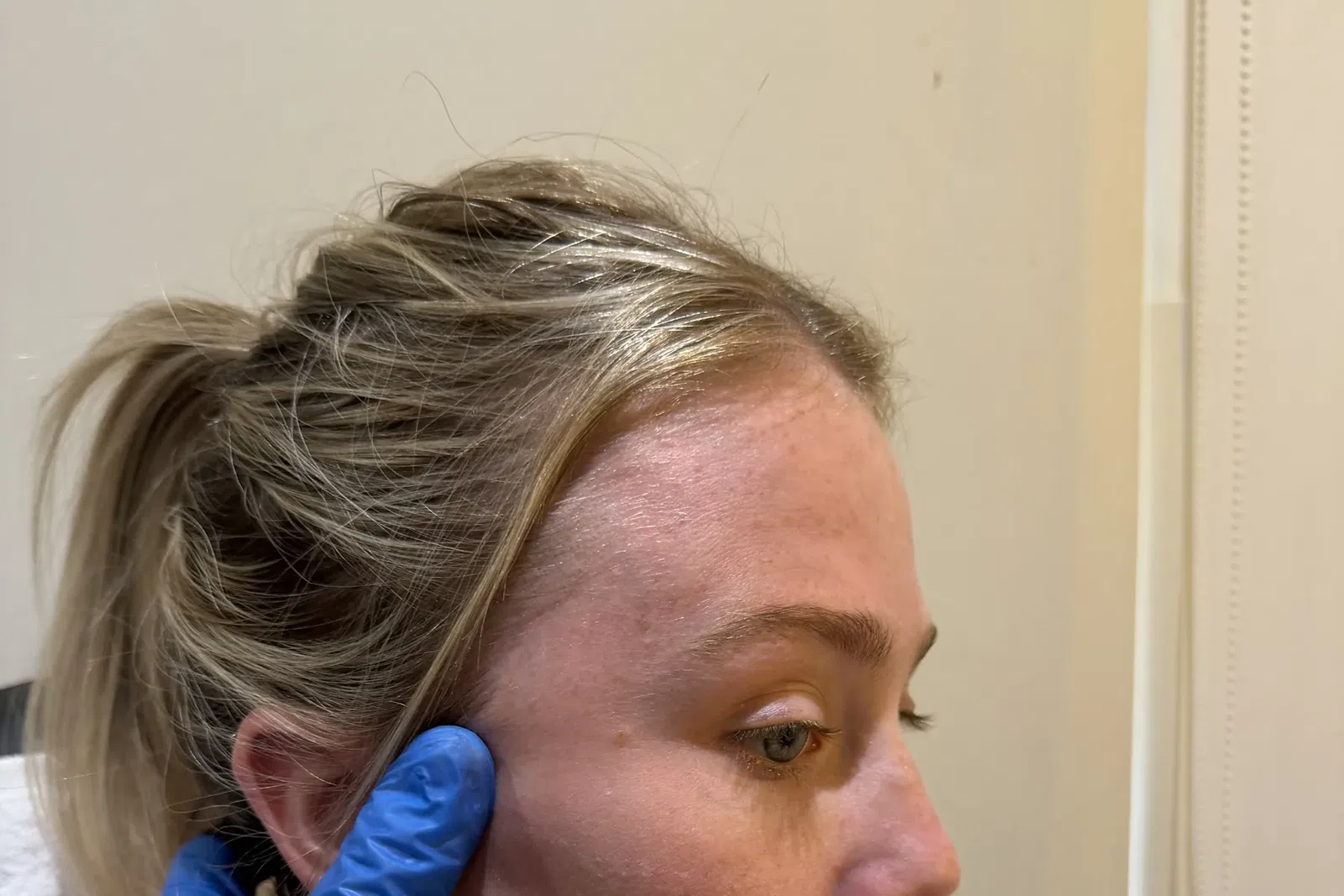 Core Aesthetics clinic context image for chin and jawline on Jaw Muscle Treatment Notting Hill
