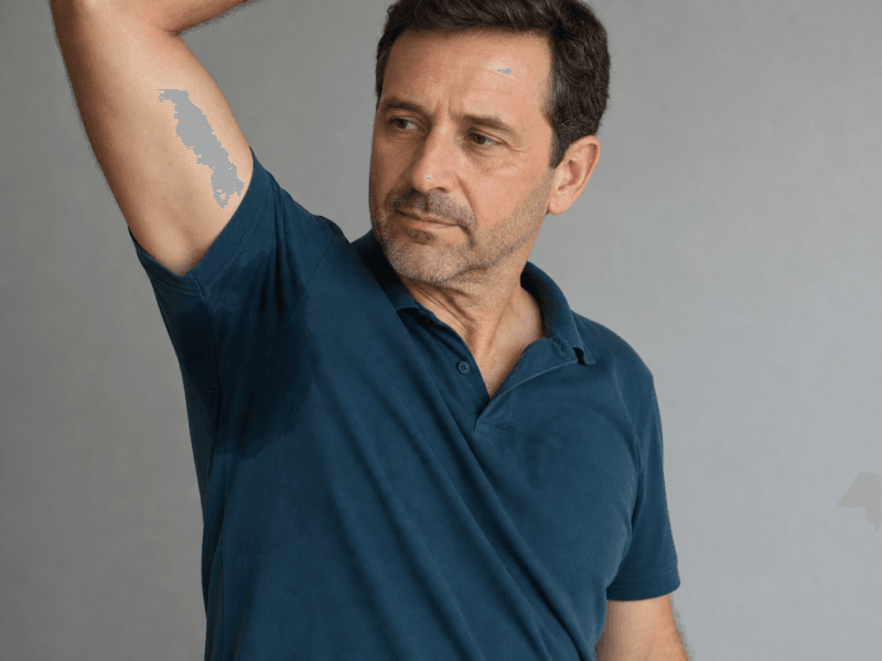 Core Aesthetics 07 male hyperhidrosis teal polo underarms