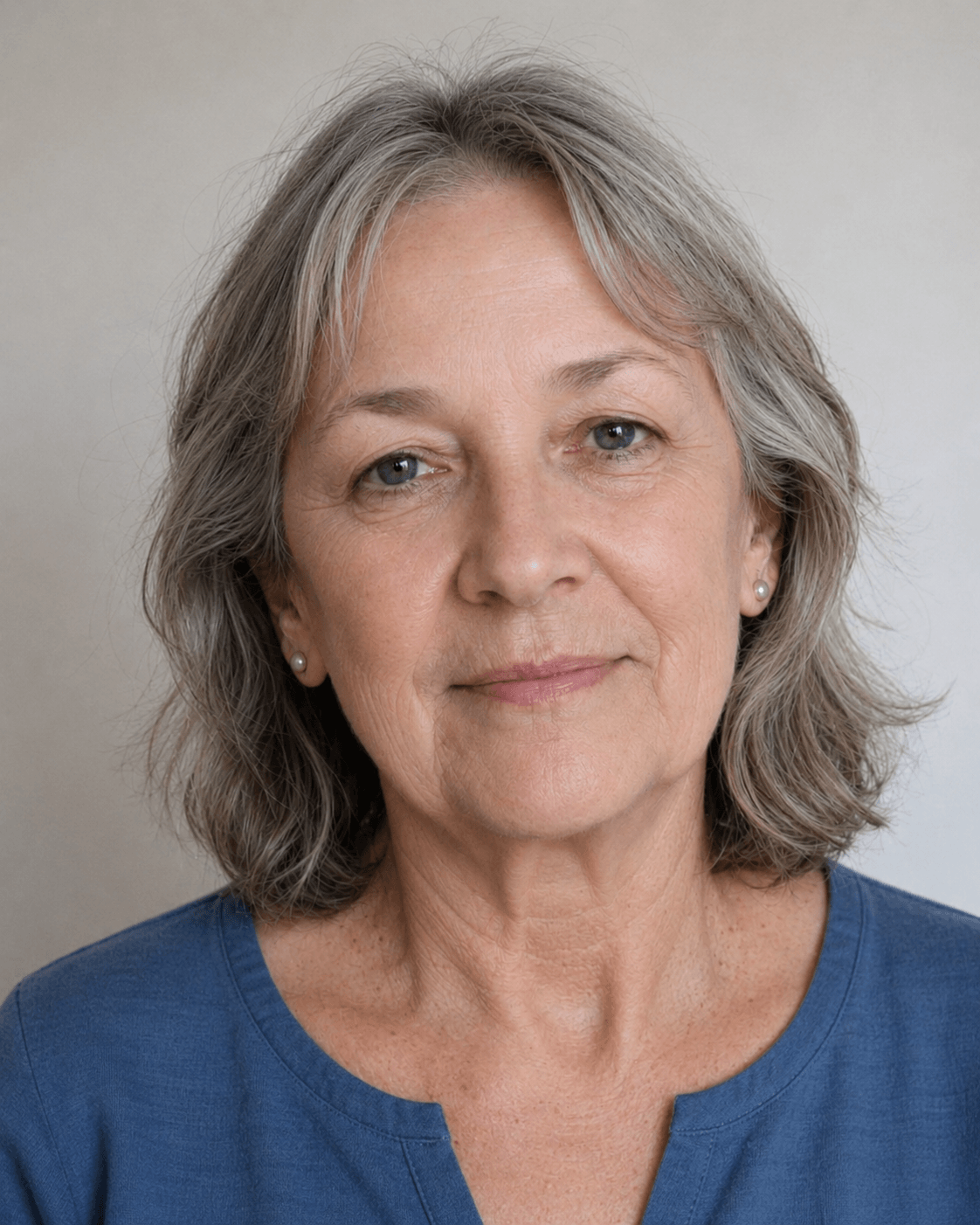 Wrinkle and upper-face consultation assessment for consultation planning at Core Aesthetics in Oakleigh