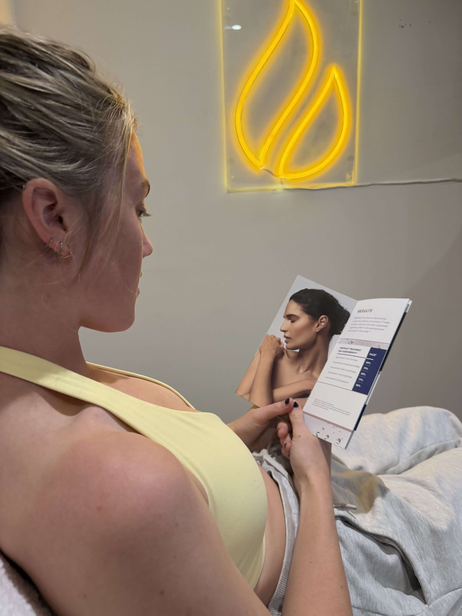 Underarm sweating consultation assessment for review and planning discussion at Core Aesthetics in Oakleigh