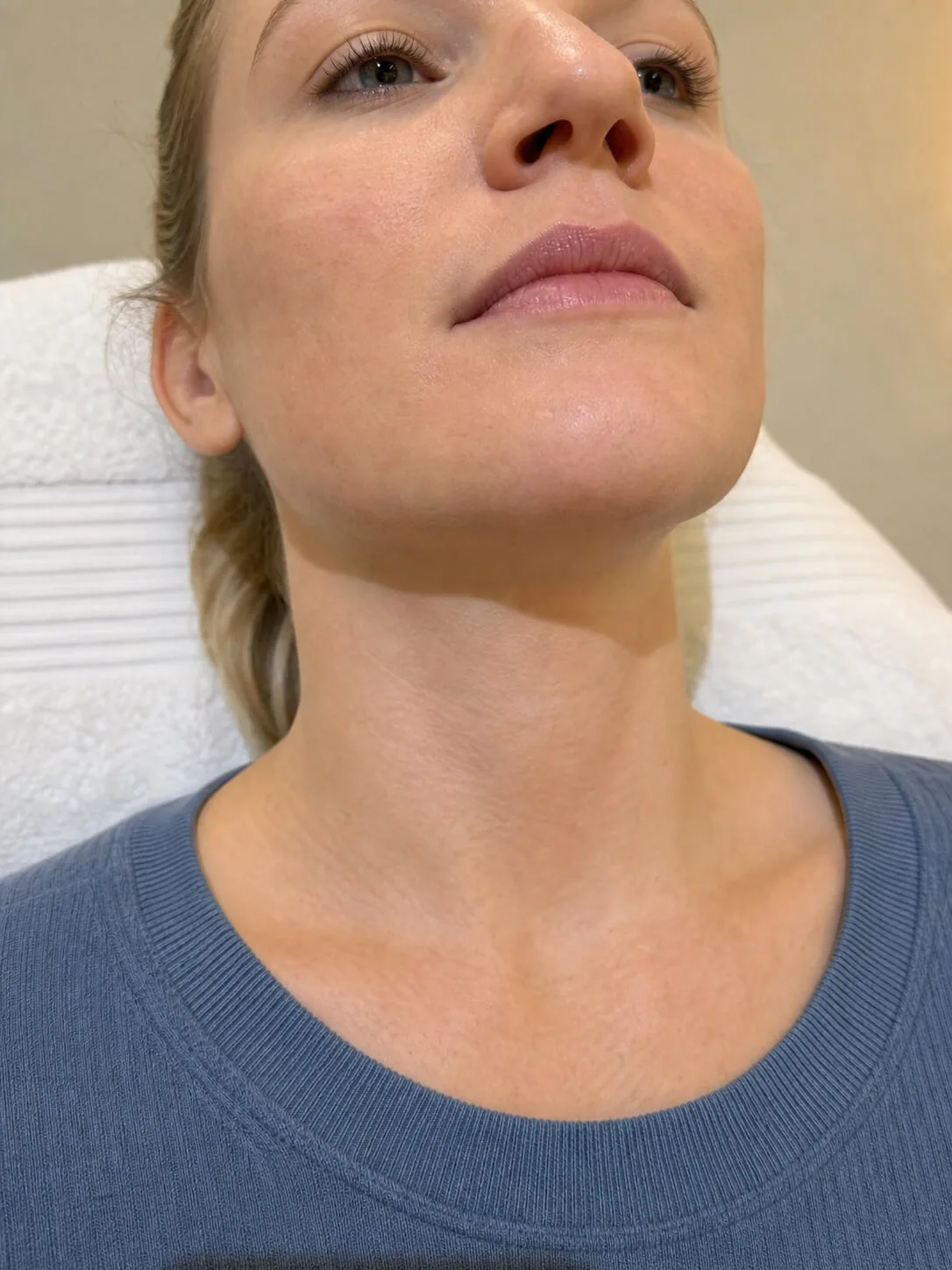 Lower-face consultation image used to explain how patients can pause, decline or bring support to a cosmetic consultation