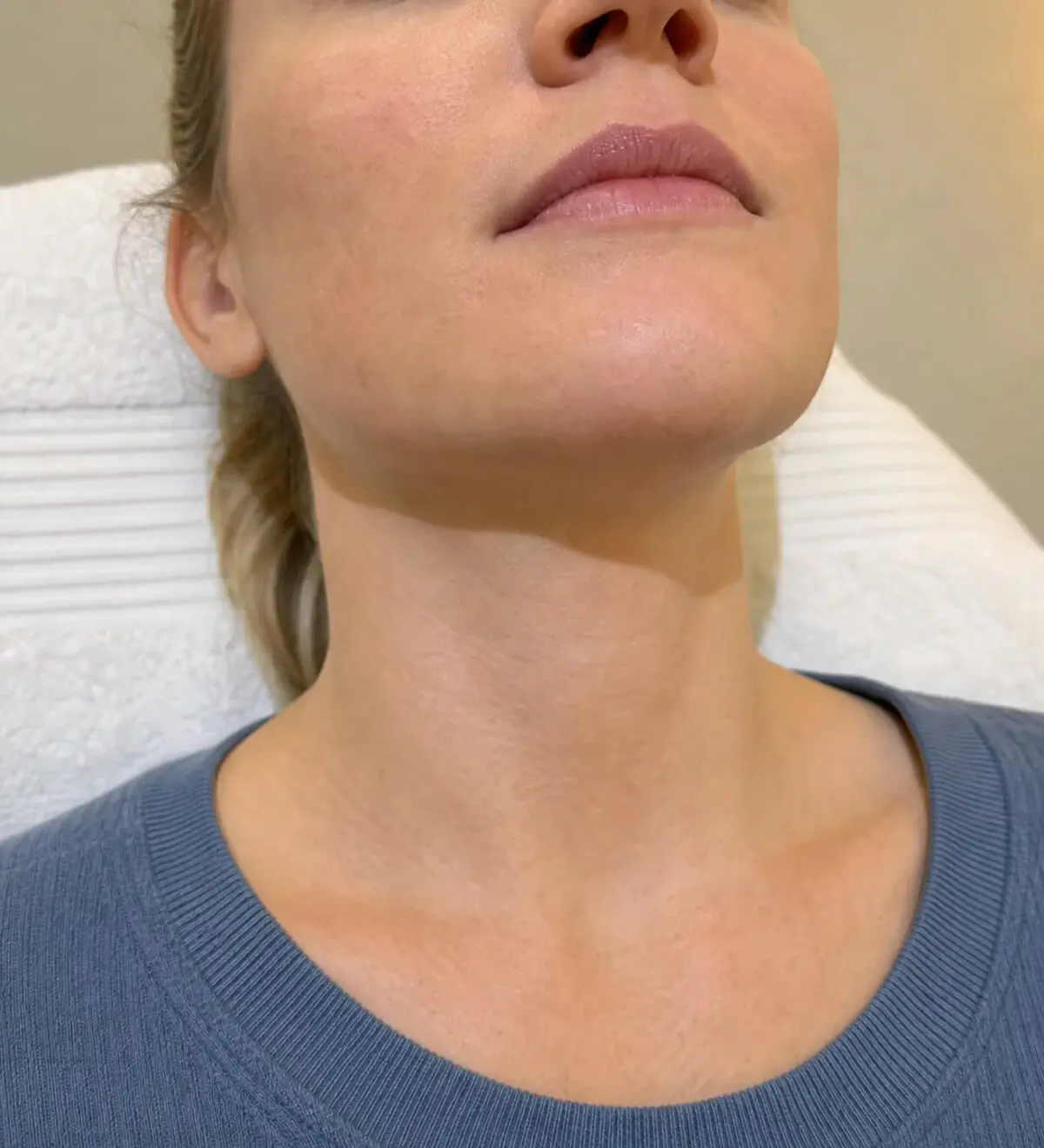 Adult woman in a lower face and neck assessment context at Core Aesthetics