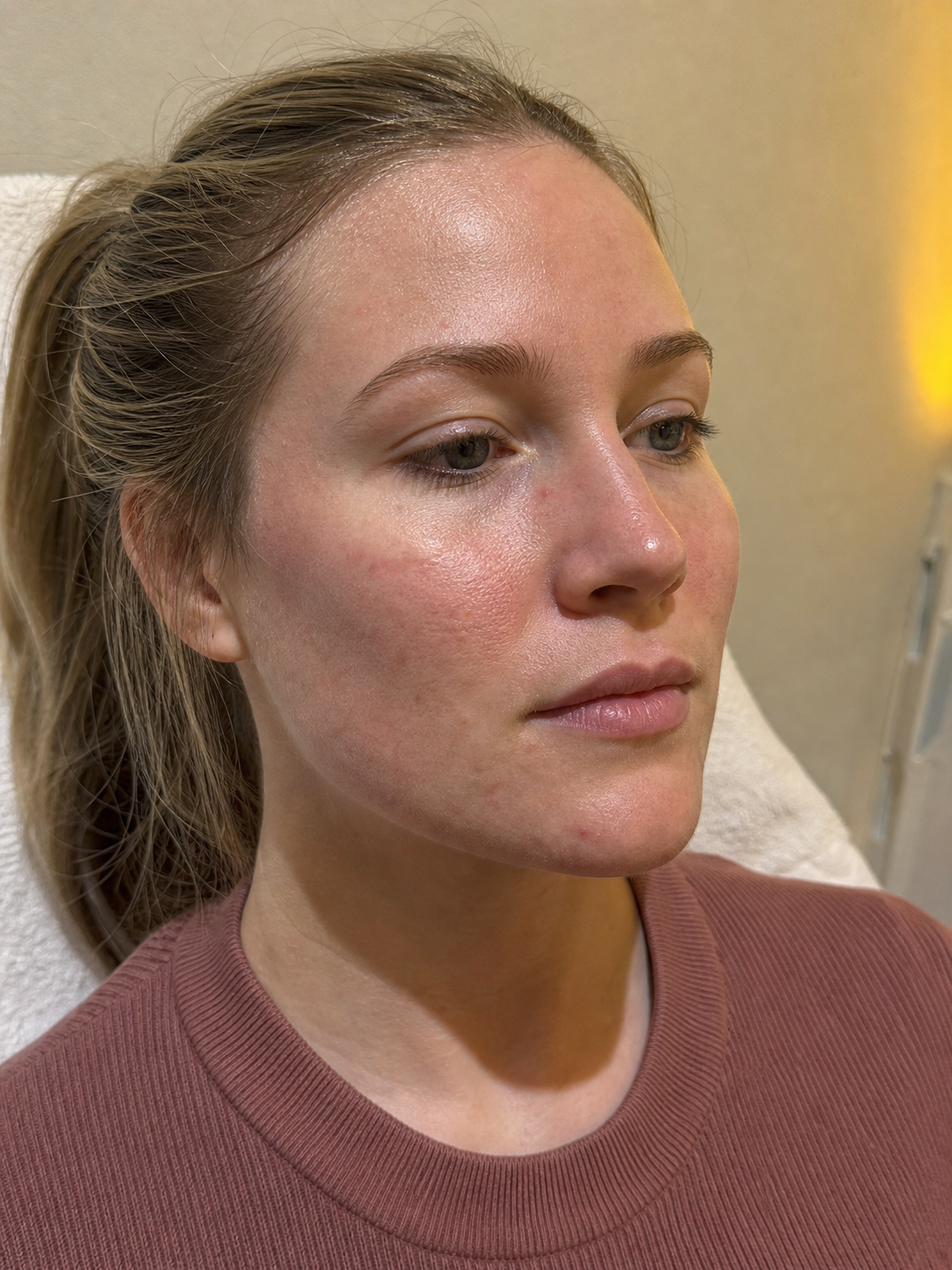 Facial structure consultation assessment for consultation planning at Core Aesthetics in Oakleigh