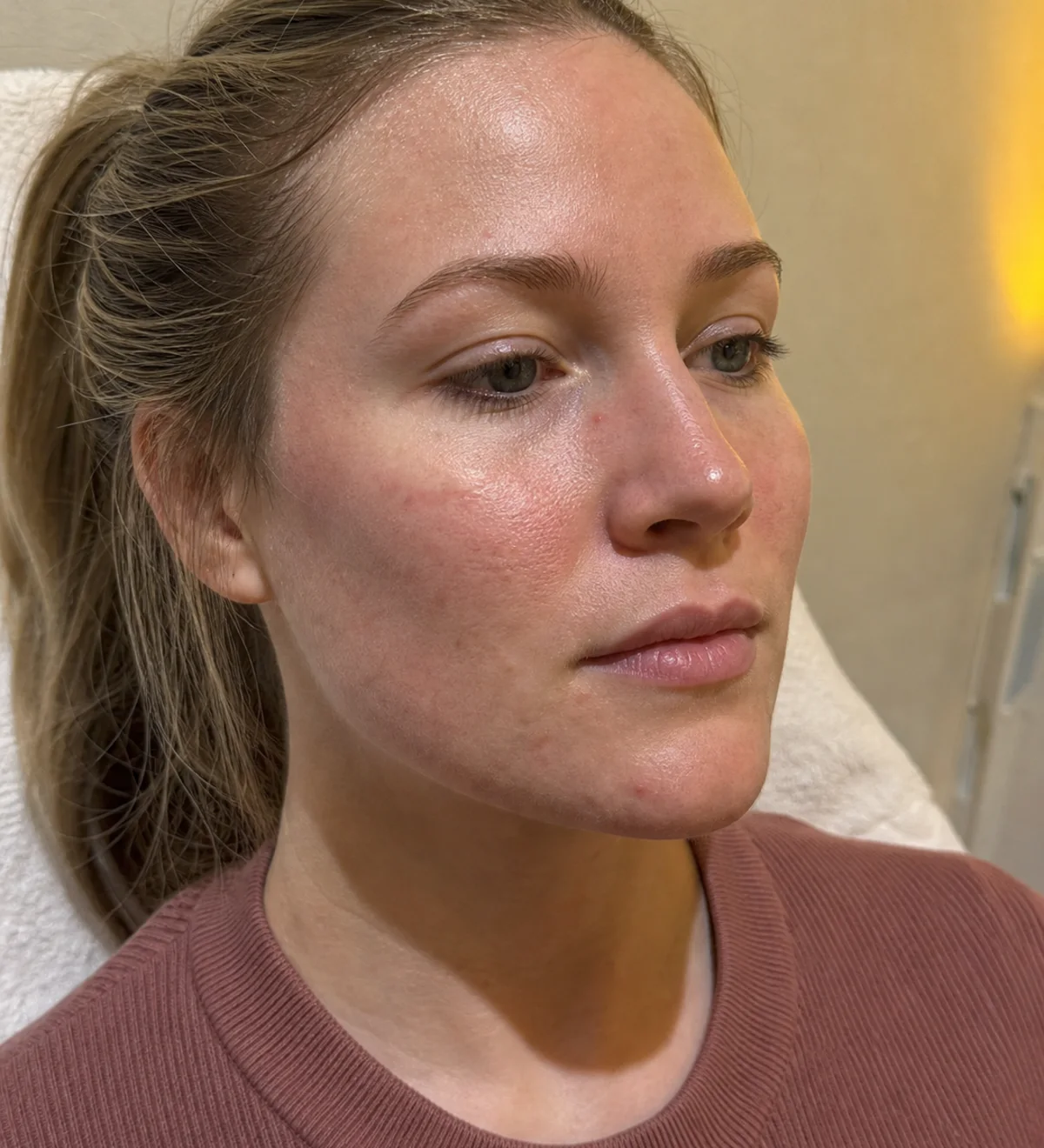 Aftercare and review consultation context for consultation planning at Core Aesthetics in Oakleigh