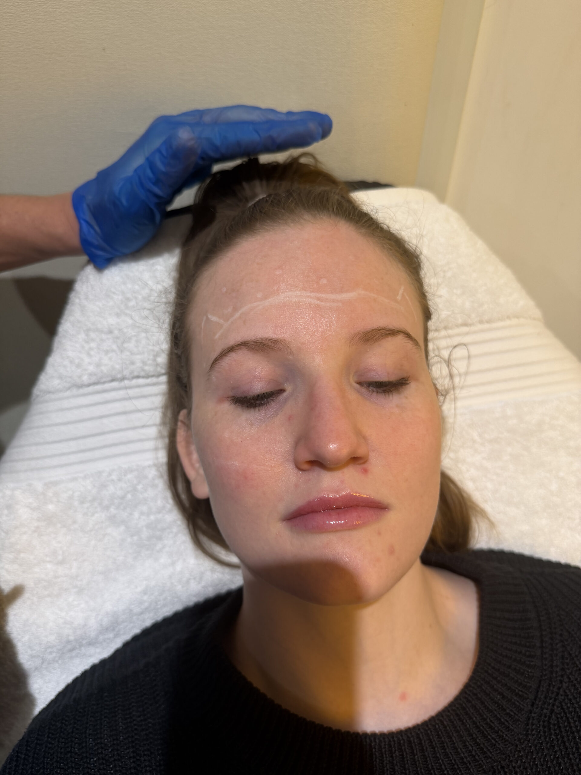 Safety and suitability consultation context for consultation planning at Core Aesthetics in Oakleigh
