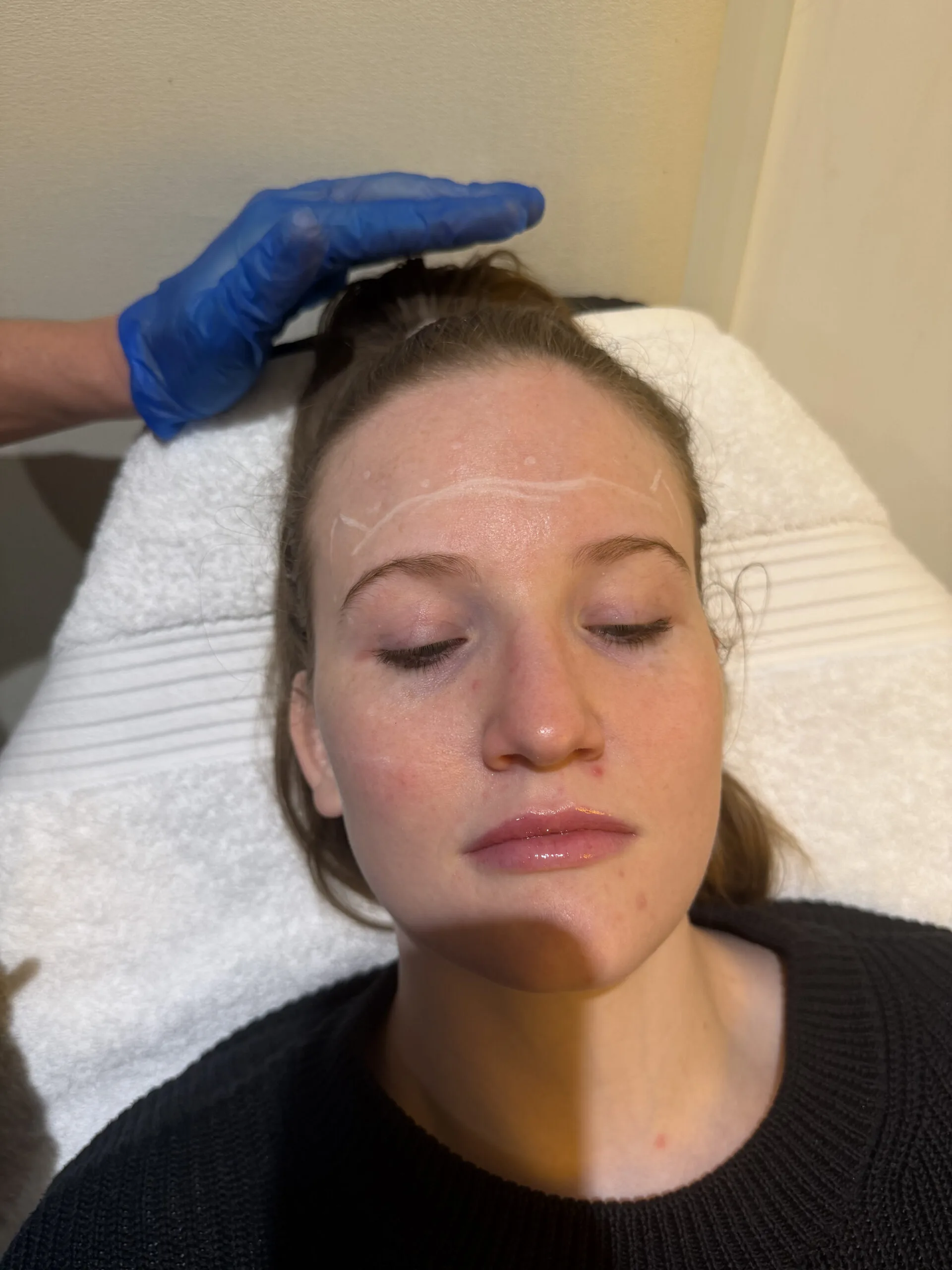 Front-facing consultation image used to explain what happens after Corey recommends waiting, referral or no treatment