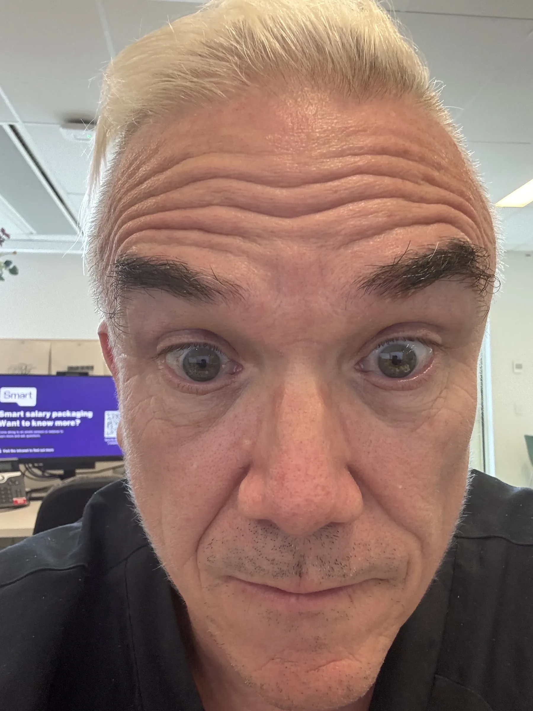 Wrinkle and upper-face consultation assessment for consultation planning at Core Aesthetics in Oakleigh