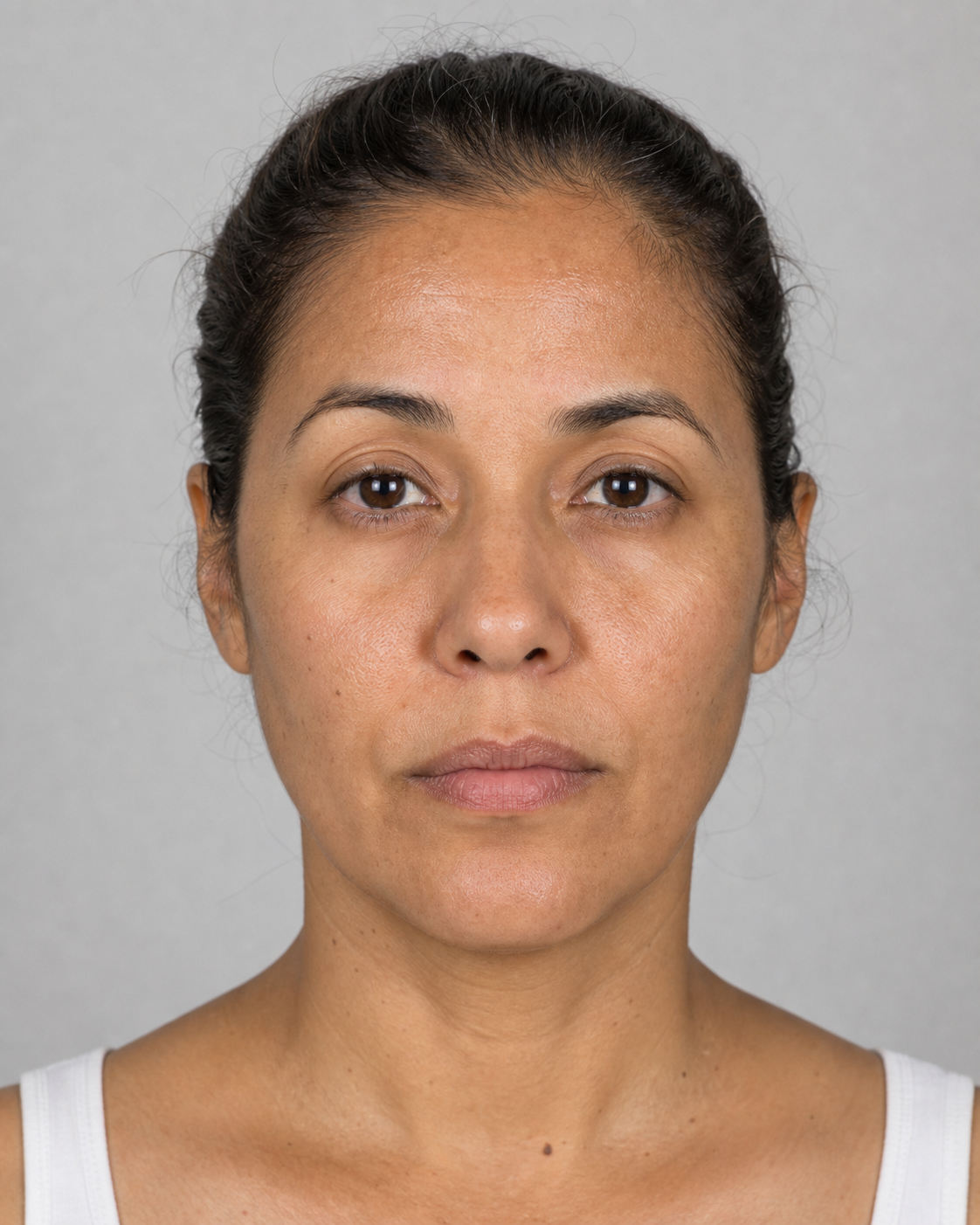 Facial structure consultation assessment for consultation planning at Core Aesthetics in Oakleigh