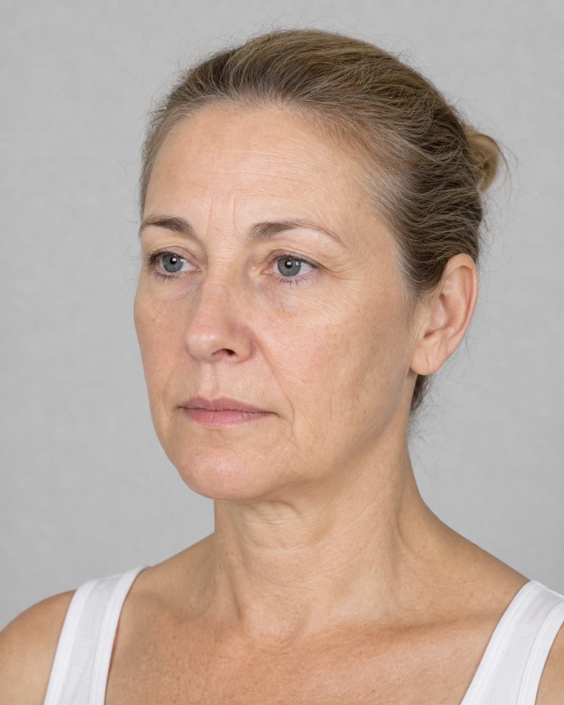 Facial structure consultation assessment for consultation planning at Core Aesthetics in Oakleigh
