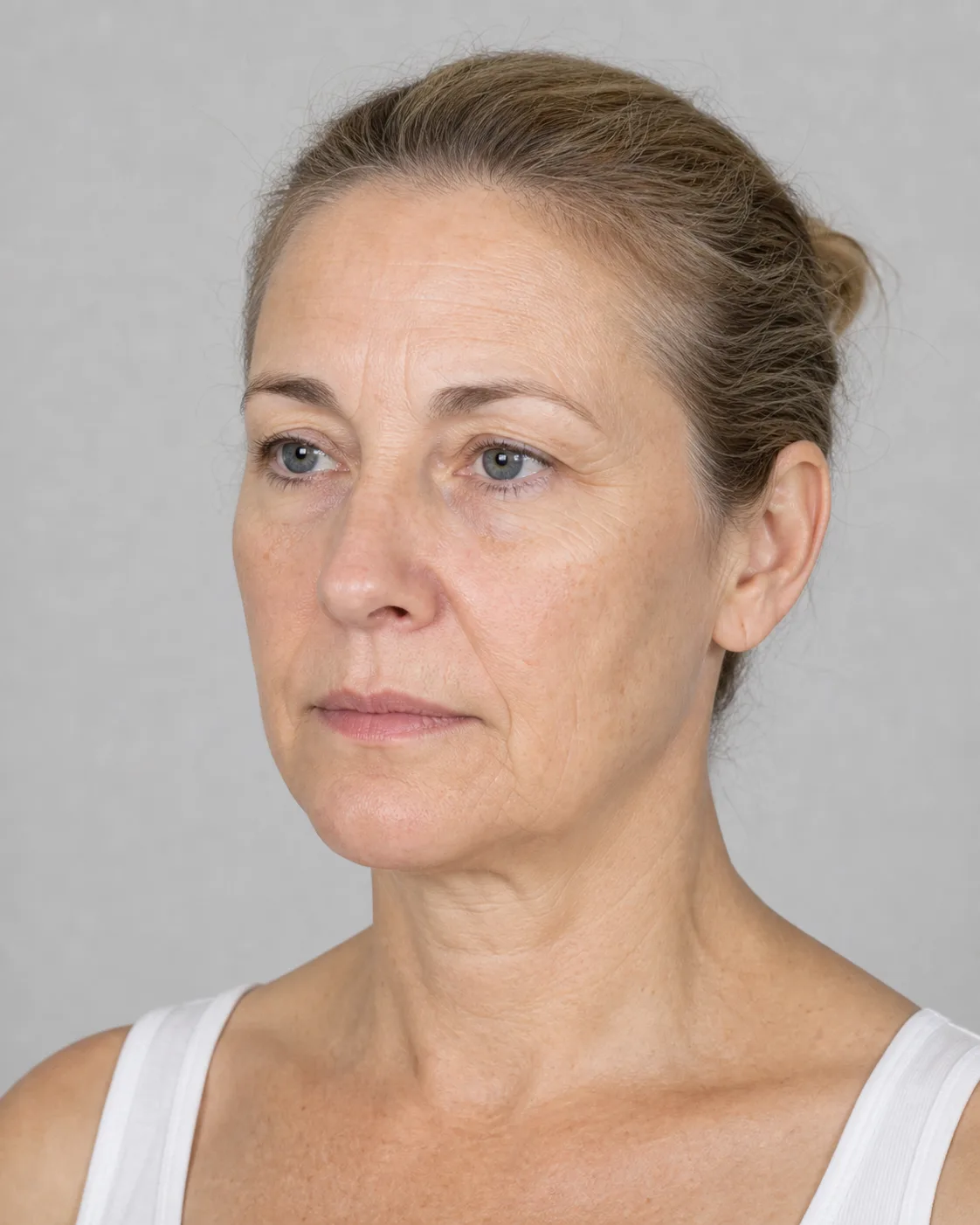 Facial structure consultation assessment for consultation planning at Core Aesthetics in Oakleigh