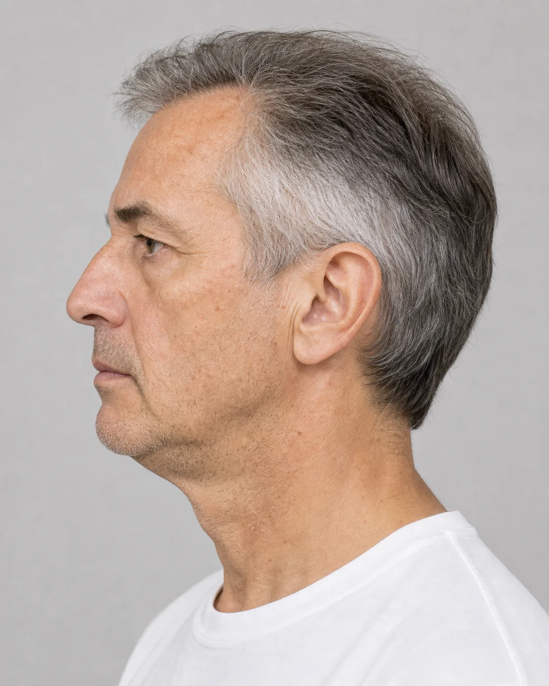Under-eye consultation assessment for consultation planning at Core Aesthetics in Oakleigh