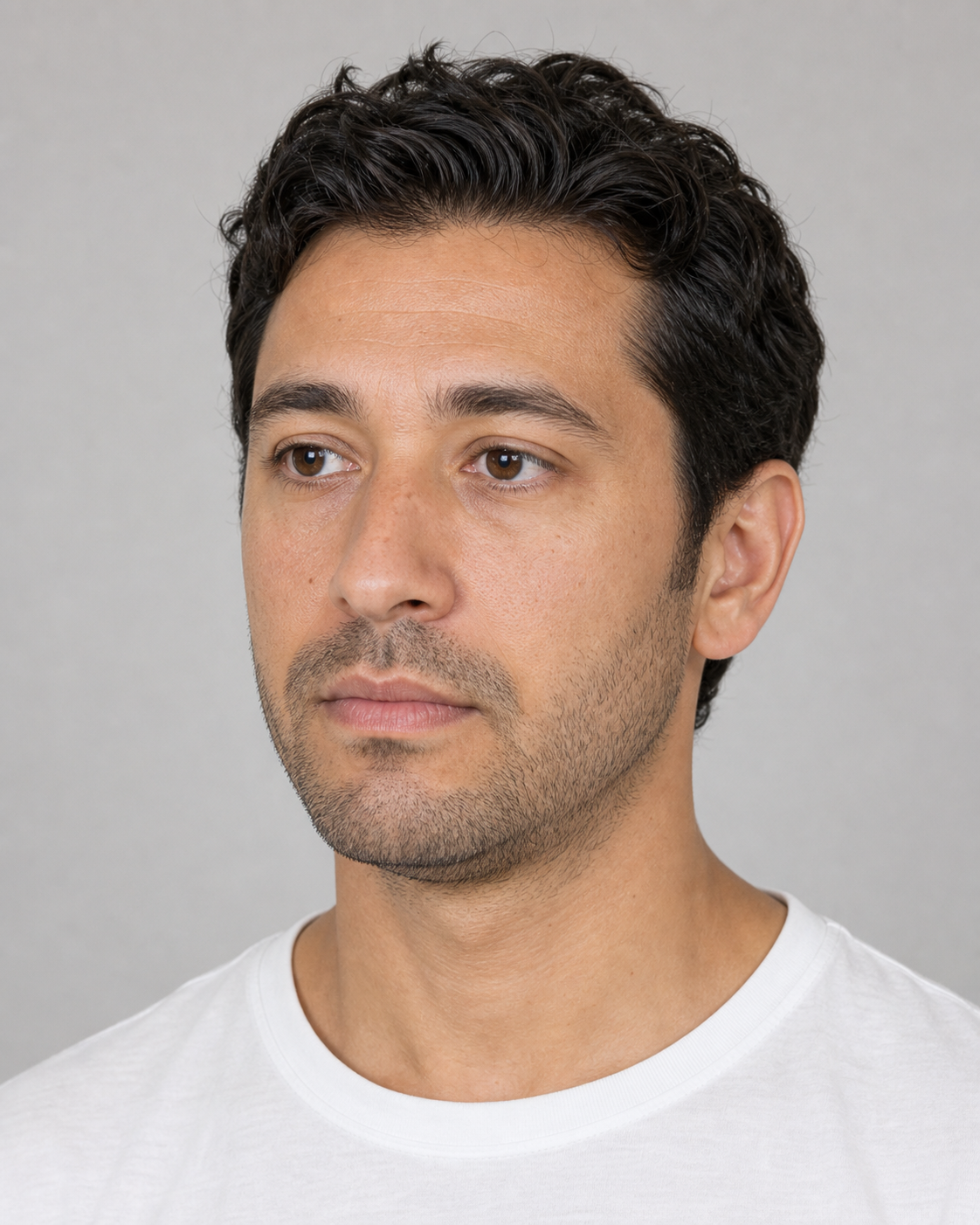 Under-eye consultation assessment for consultation planning at Core Aesthetics in Oakleigh