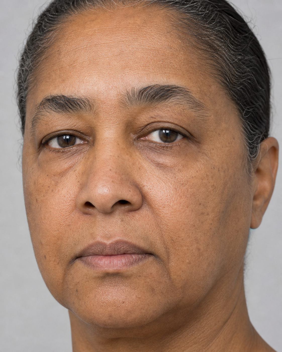 Facial structure consultation assessment for consultation planning at Core Aesthetics in Oakleigh