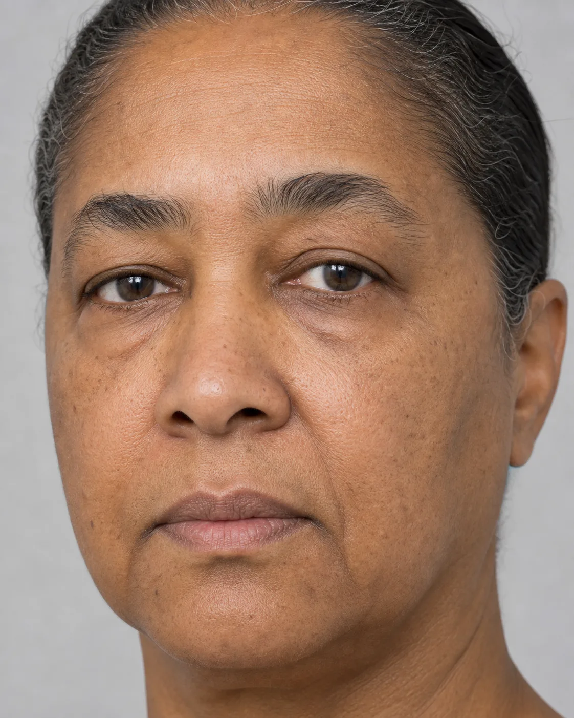 Female close facial view showing natural cheek side difference and skin detail