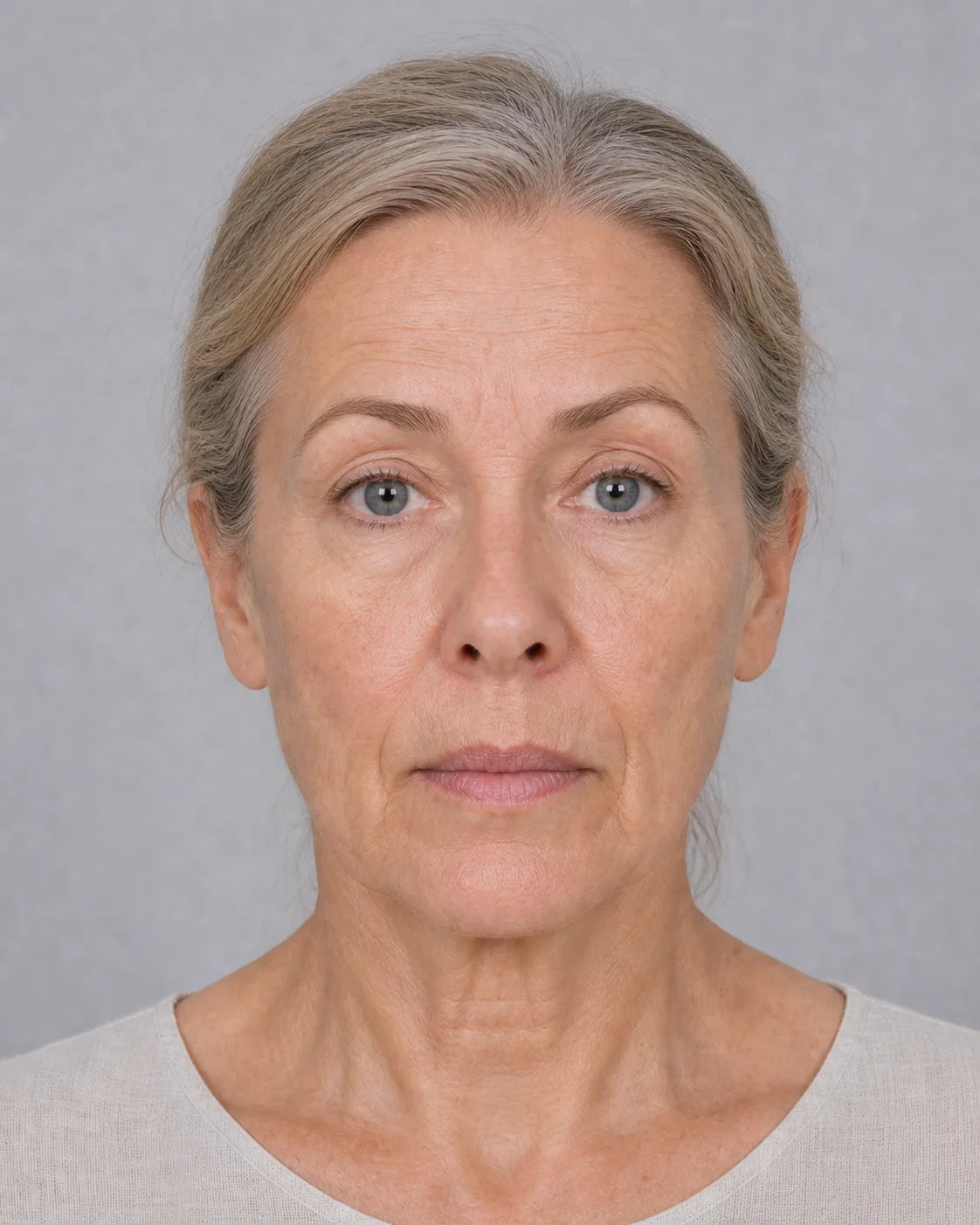 Illustrative neutral front portrait used to demonstrate consistent lighting for a bruising timeline photograph
