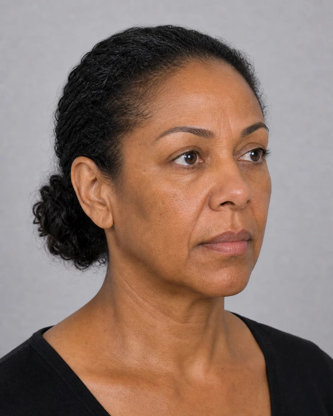 Three-quarter brow and forehead portrait shown for general information at Core Aesthetics in Oakleigh