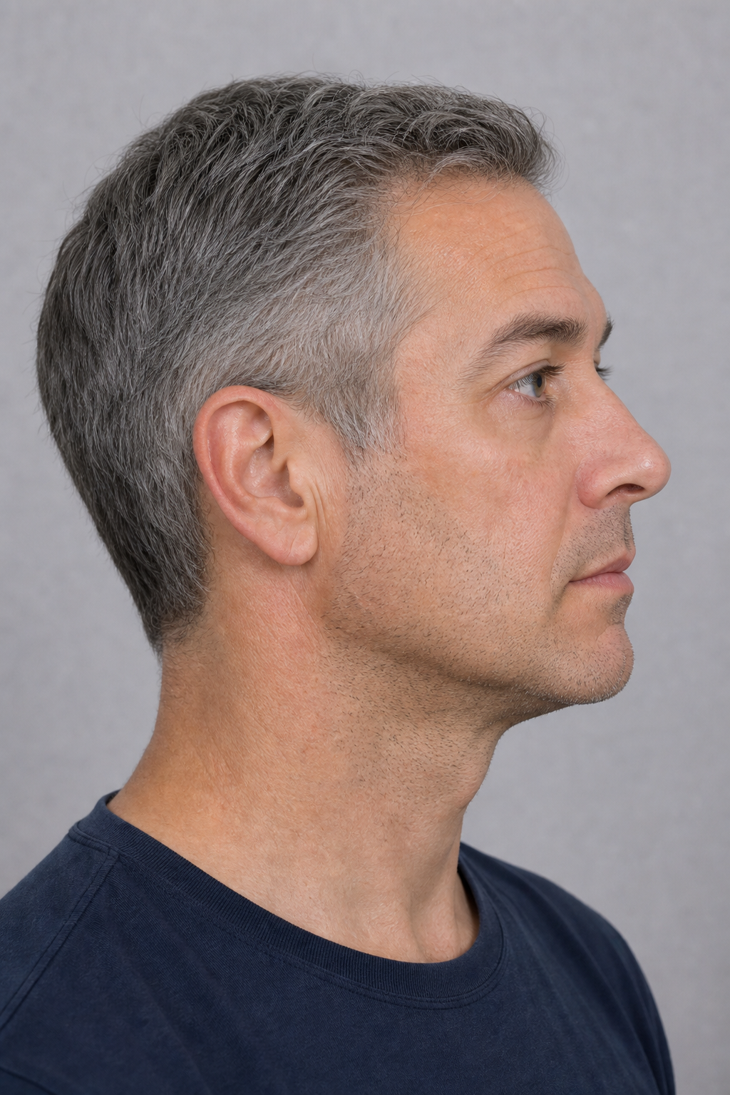 Wrinkle and upper-face consultation assessment for consultation planning at Core Aesthetics in Oakleigh