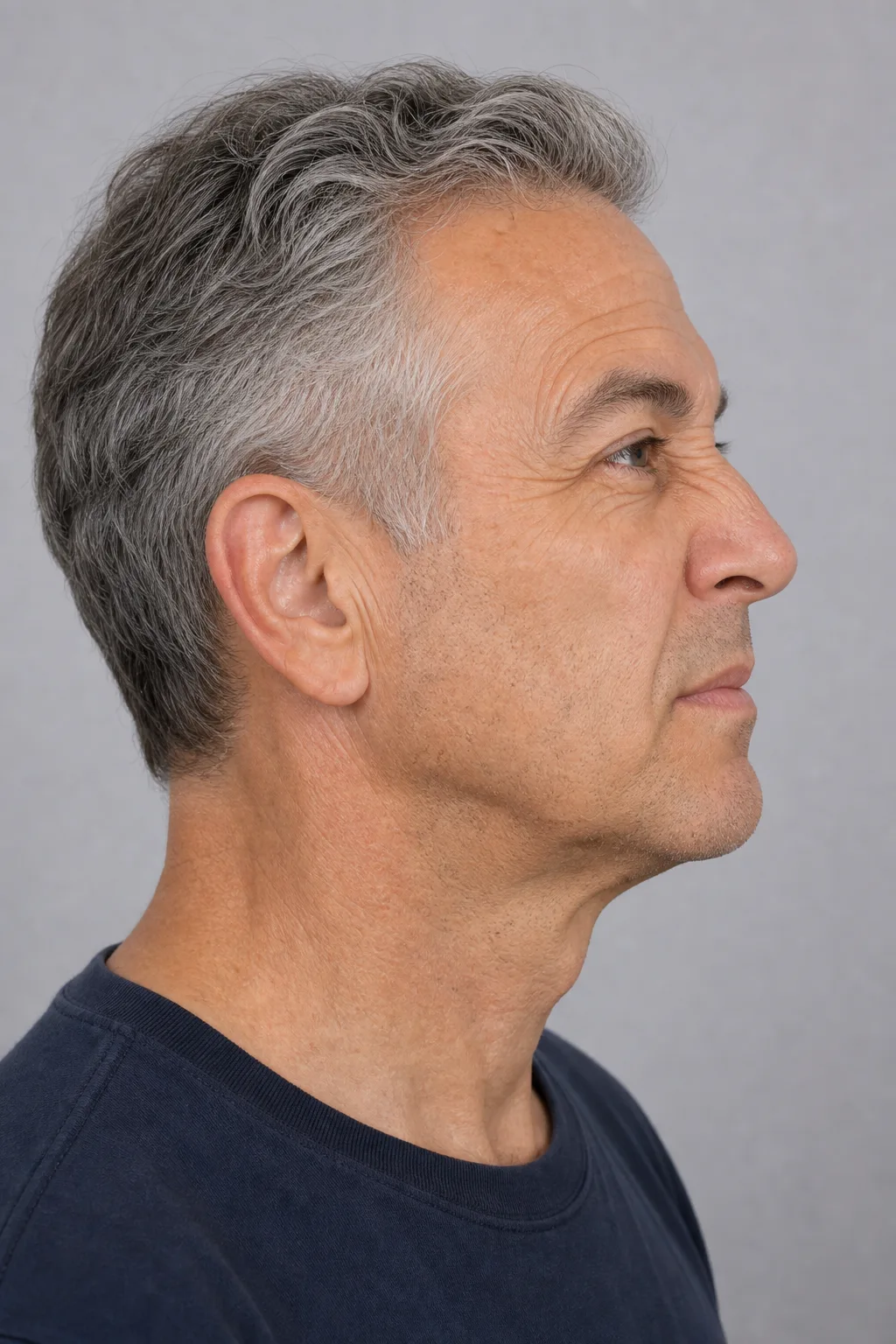 Wrinkle and upper-face consultation assessment for consultation planning at Core Aesthetics in Oakleigh