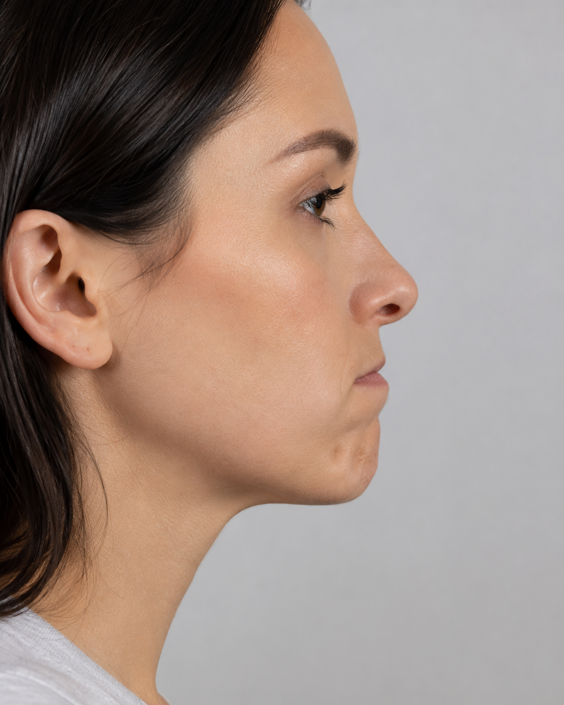 Chin and jawline consultation assessment for consultation planning at Core Aesthetics in Oakleigh