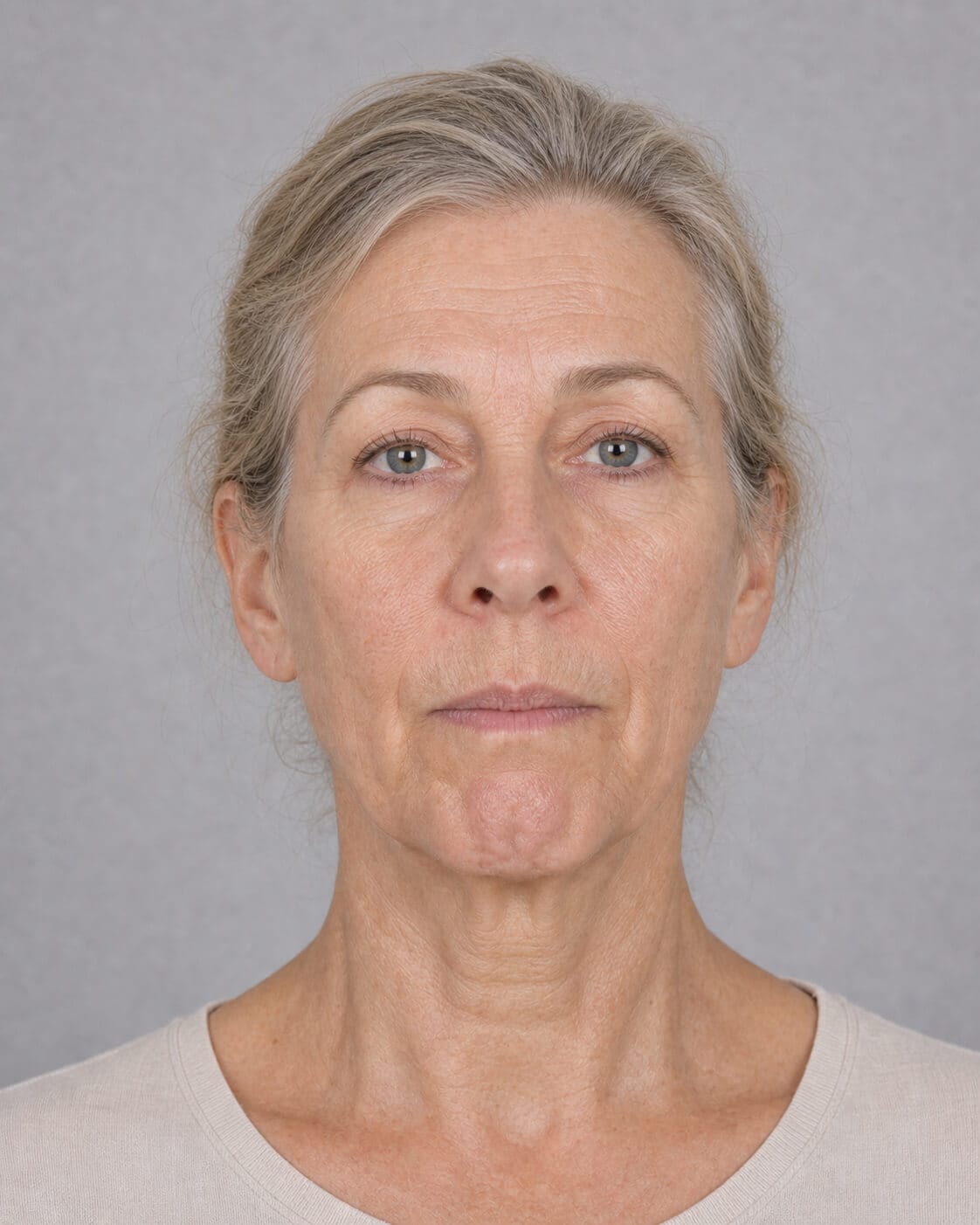 Chin and jawline consultation assessment for consultation planning at Core Aesthetics in Oakleigh