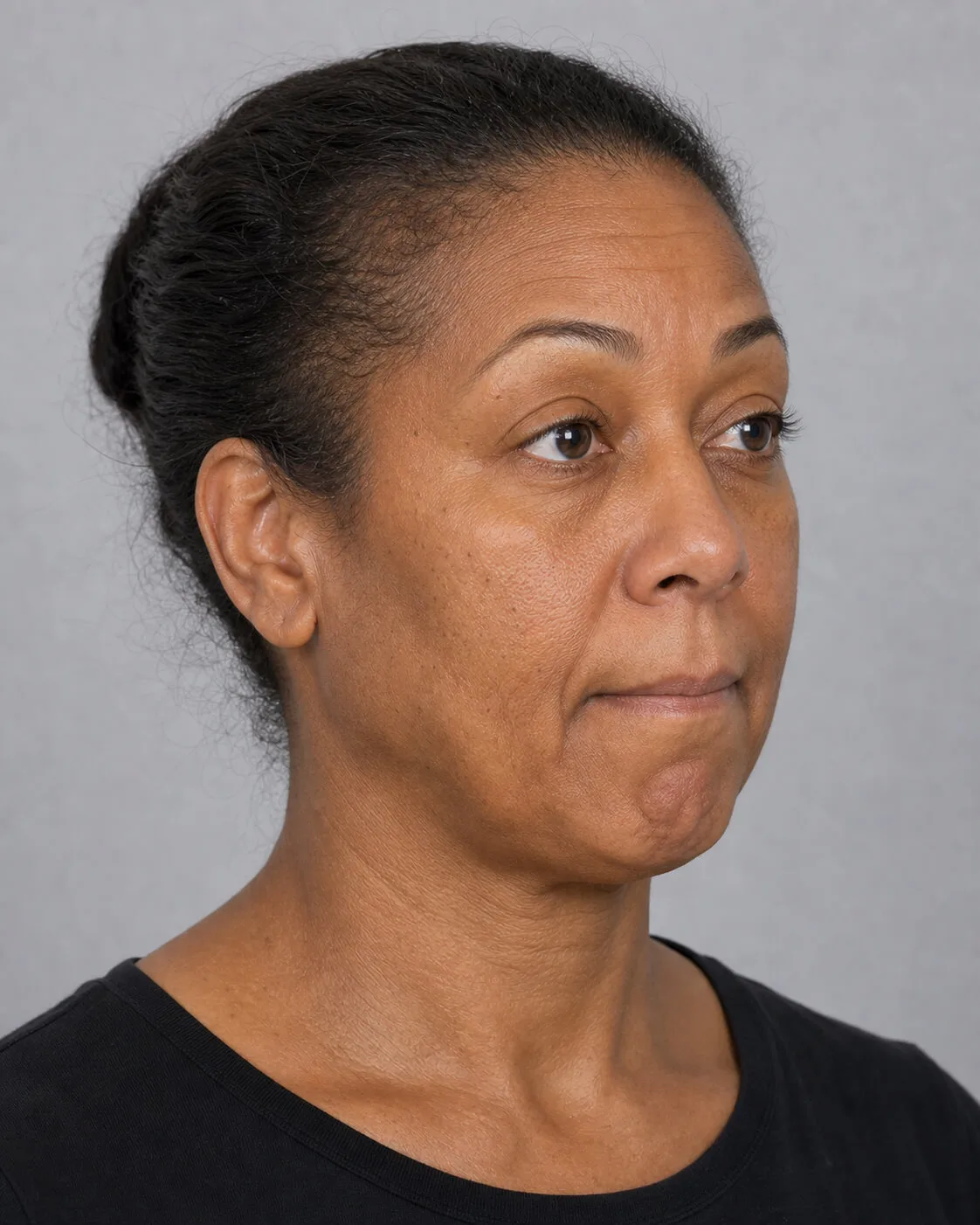 Adult woman viewed from the side while jawline and chin relationships are considered