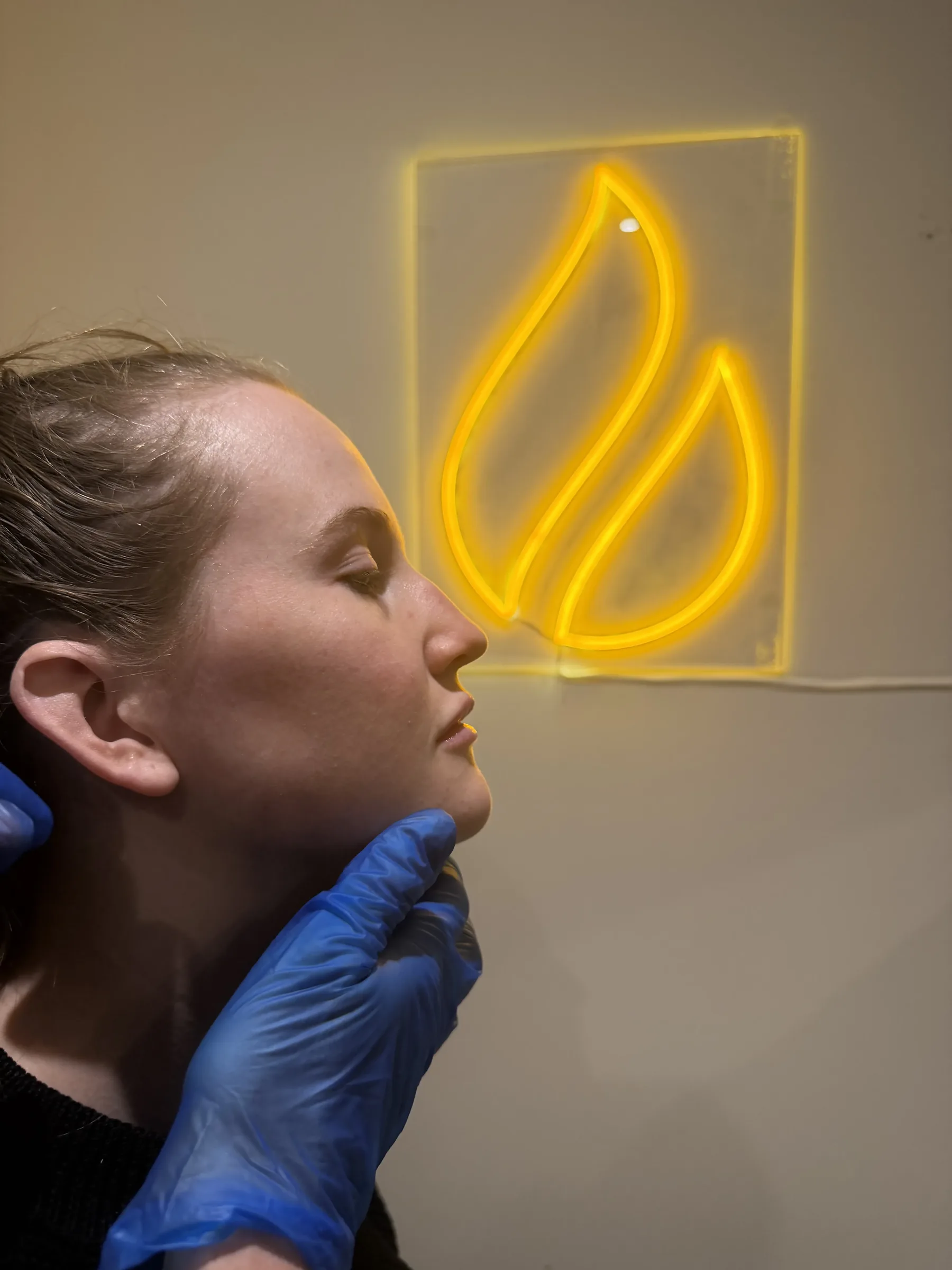 Adult woman shown in profile beside information about a personal chin and lower-face consultation