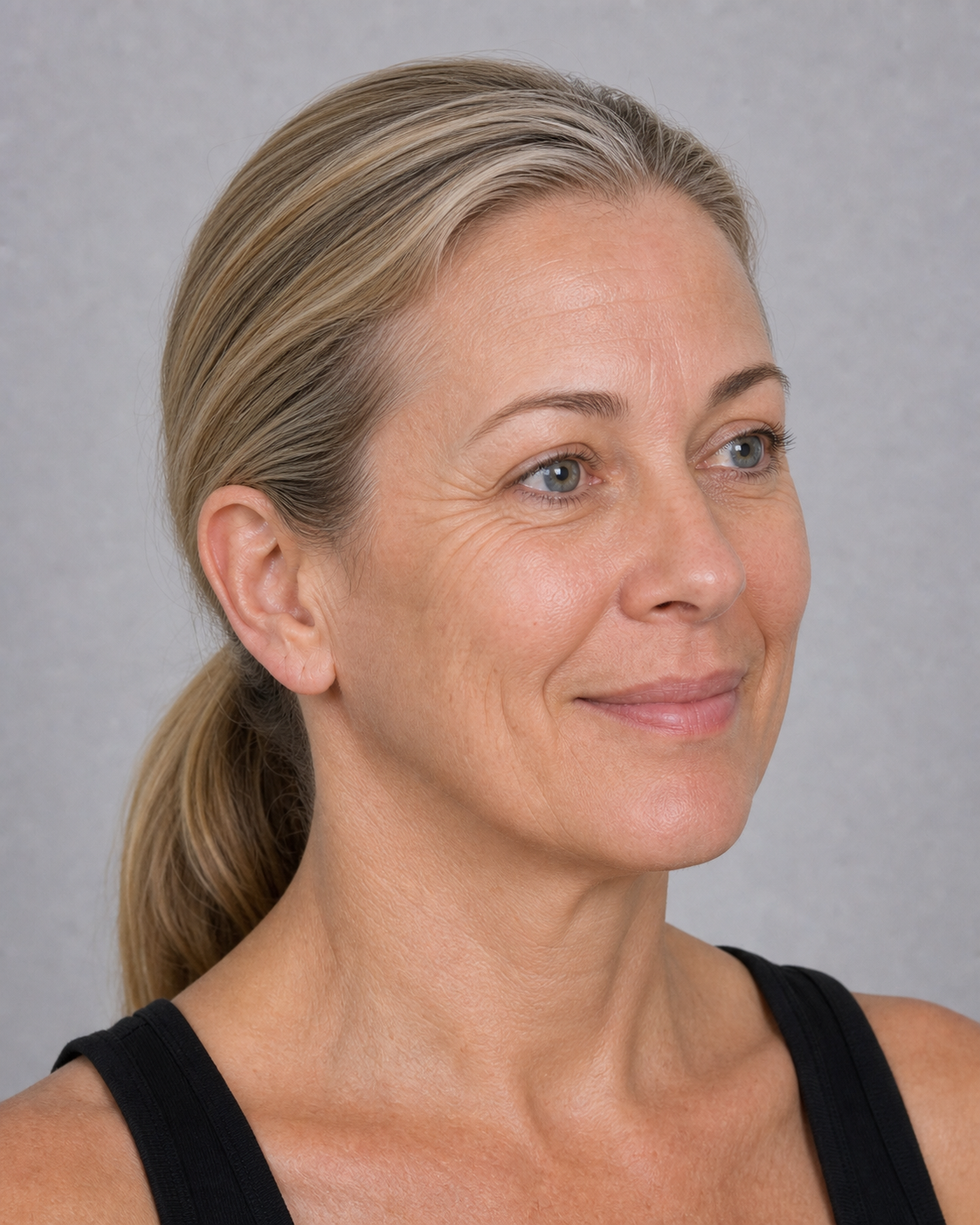 Wrinkle and upper-face consultation assessment for consultation planning at Core Aesthetics in Oakleigh