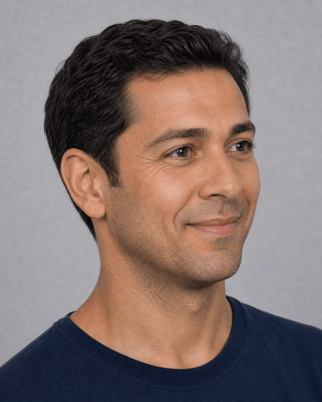 Wrinkle and upper-face consultation assessment for consultation planning at Core Aesthetics in Oakleigh