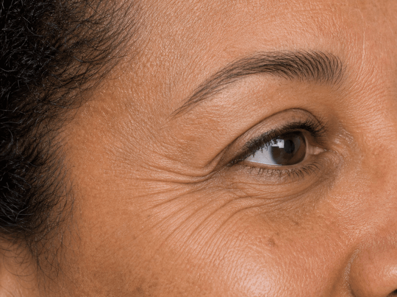 Close outer-eye view showing natural skin texture and smile-related lines