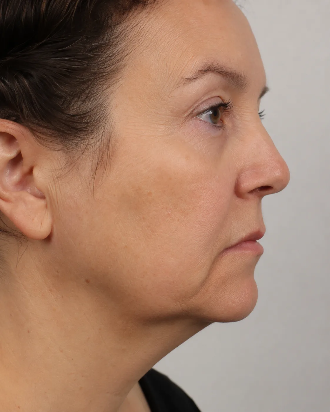 Adult woman in a side view used to discuss lip movement and lower face balance