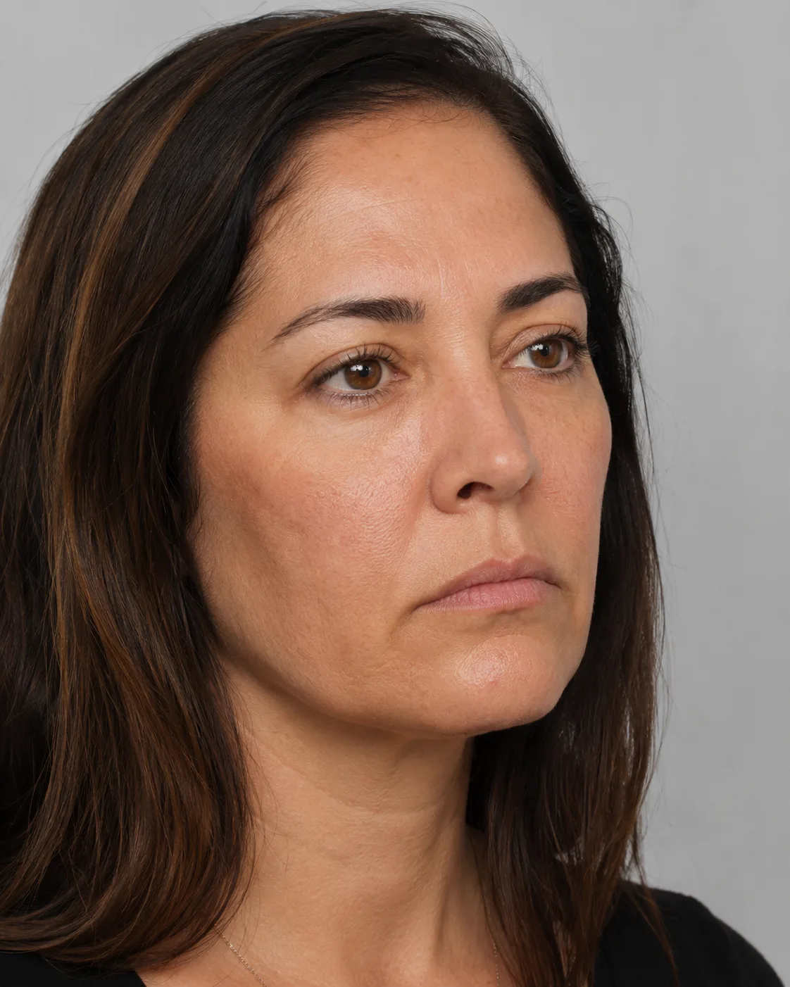 Adult patient in a three-quarter consultation view for discussing lip movement and lower face balance