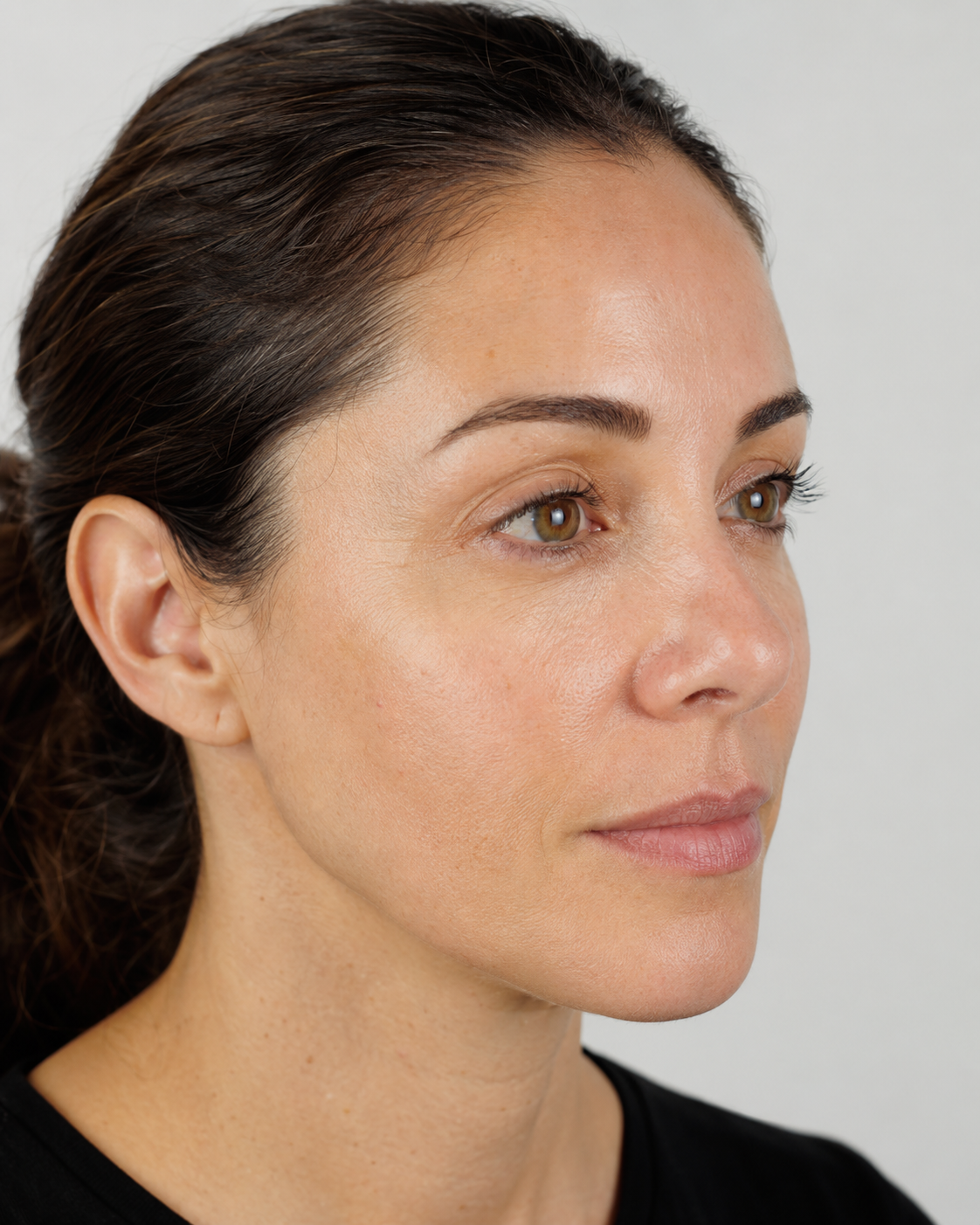 Wrinkle and upper-face consultation assessment for consultation planning at Core Aesthetics in Oakleigh