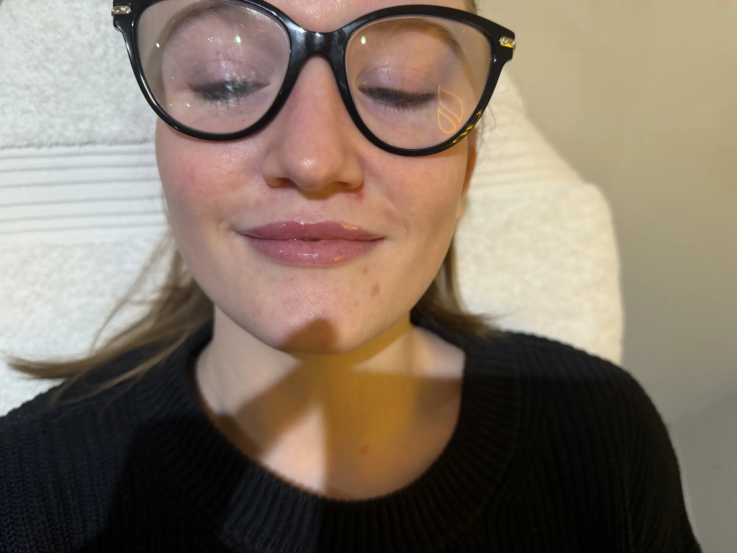 Core Aesthetics Oakleigh clinic facial ageing and anatomy assessment consultation figure 11 supporting Same Day Treatment Is Conditional and what is needed for facial ageing