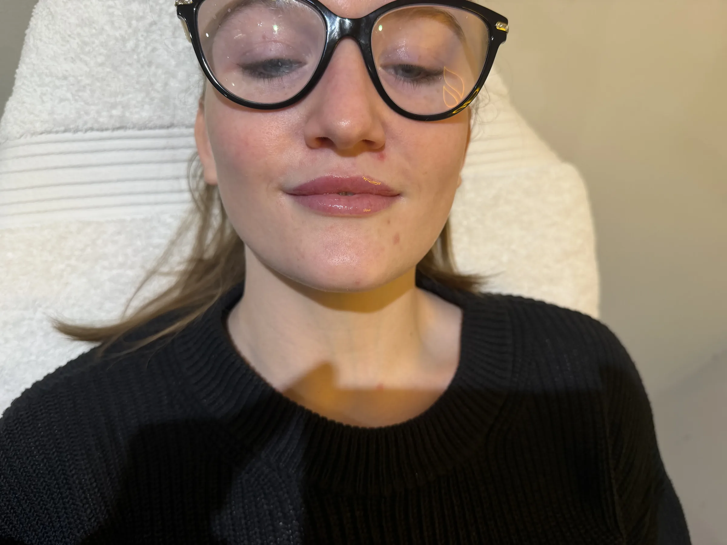 Core Aesthetics Oakleigh clinic educational assessment visual supporting What The Assessment Can And Cannot Tell You and whole face ageing assessment