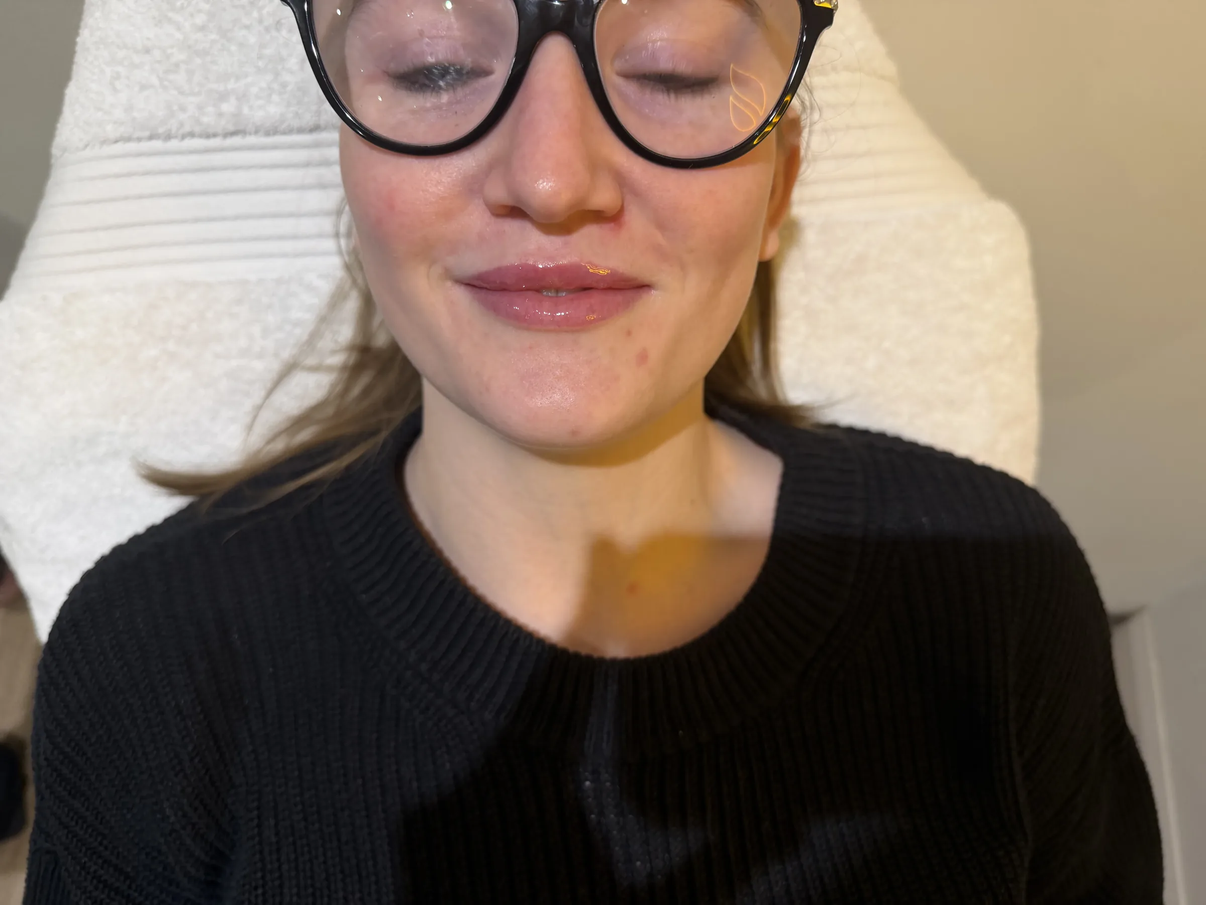 Core Aesthetics Oakleigh clinic facial ageing and anatomy assessment consultation figure 8 supporting When Treatment May Be Delayed and candidate suitability for facial ageing