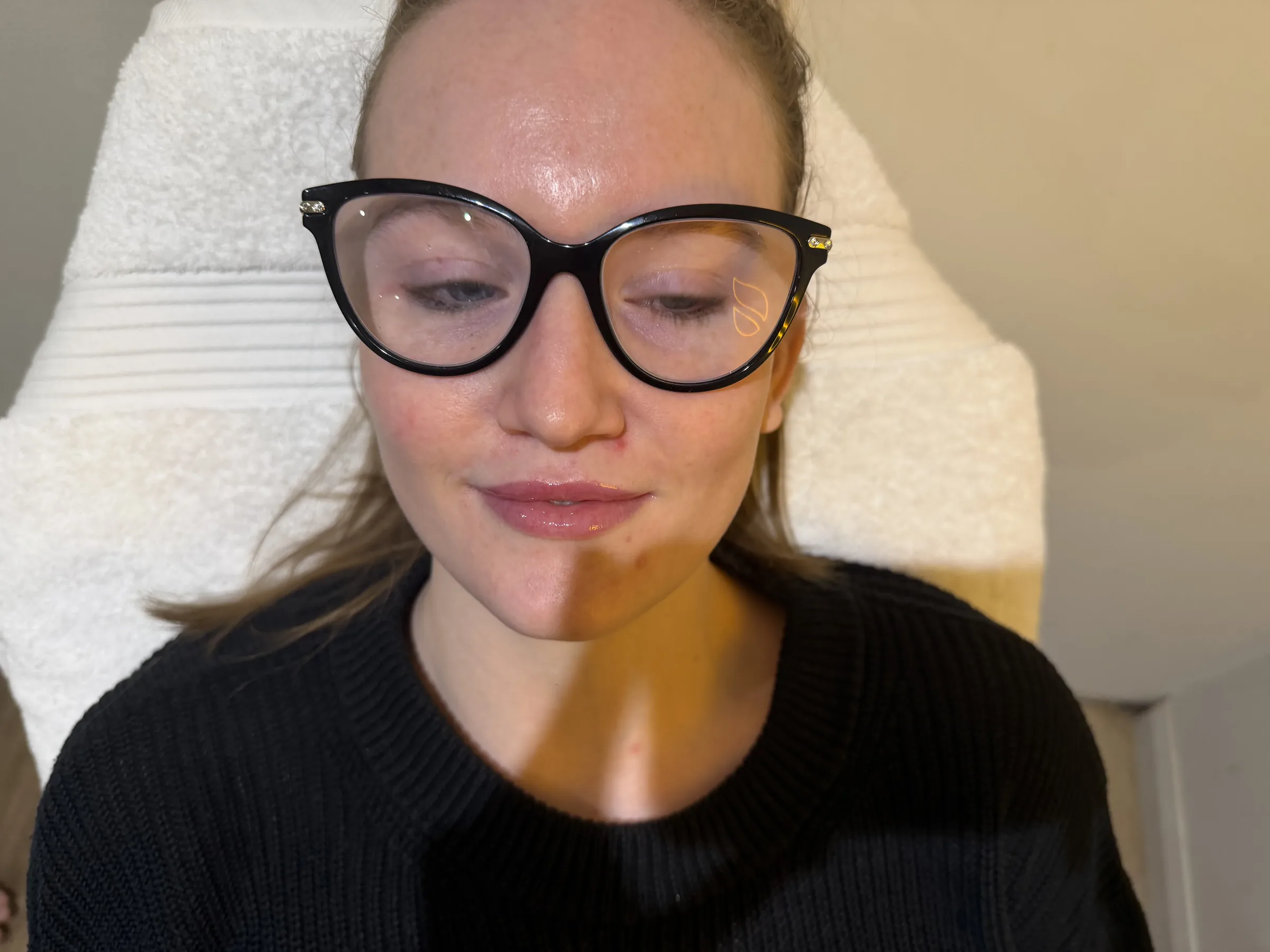 Adult front facing facial balance assessment at Core Aesthetics Oakleigh