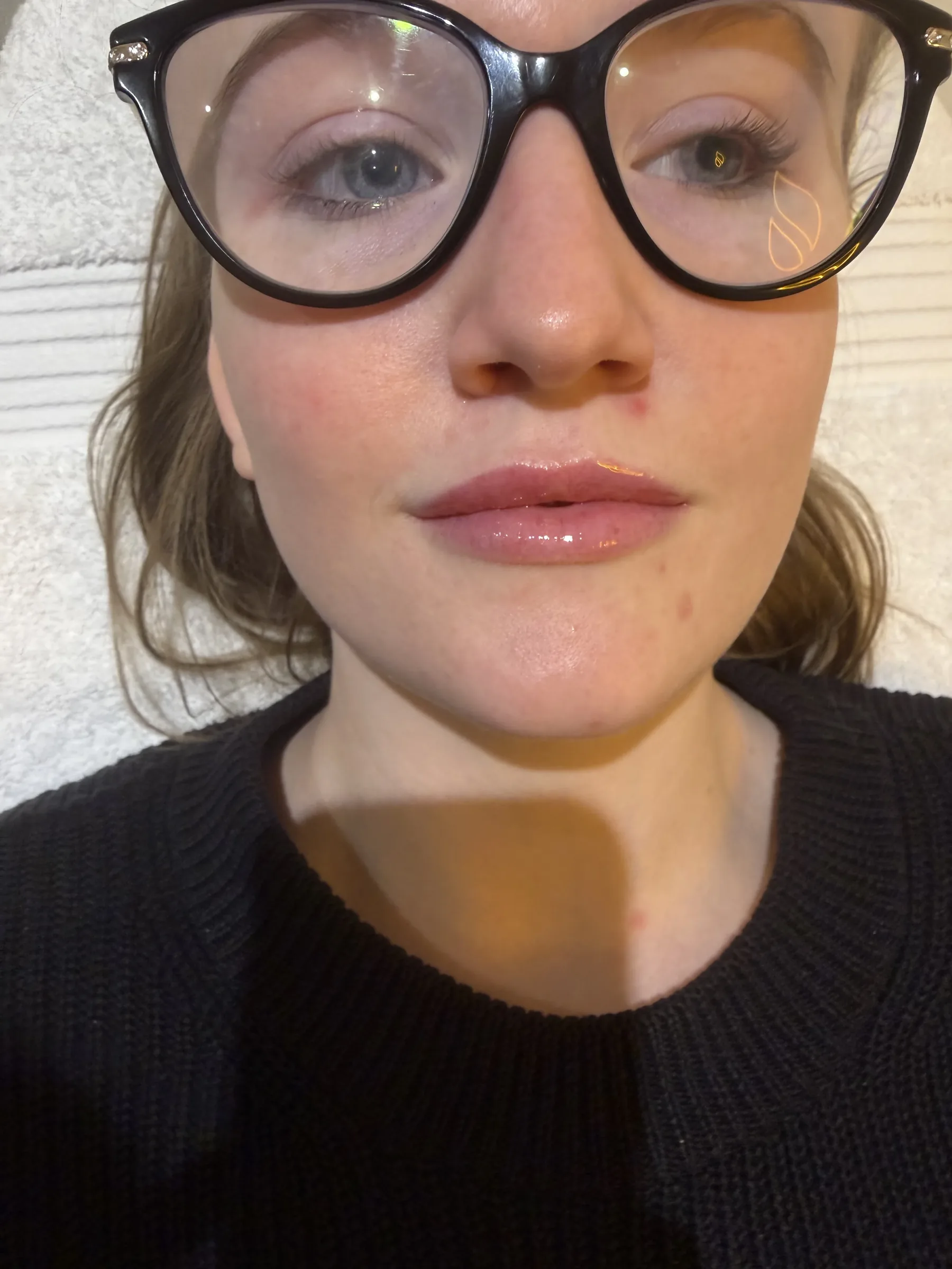 Core Aesthetics Oakleigh clinic facial volume and midface assessment consultation figure 8 supporting When Medical Review Comes First and eye area ageing and under eye assessment