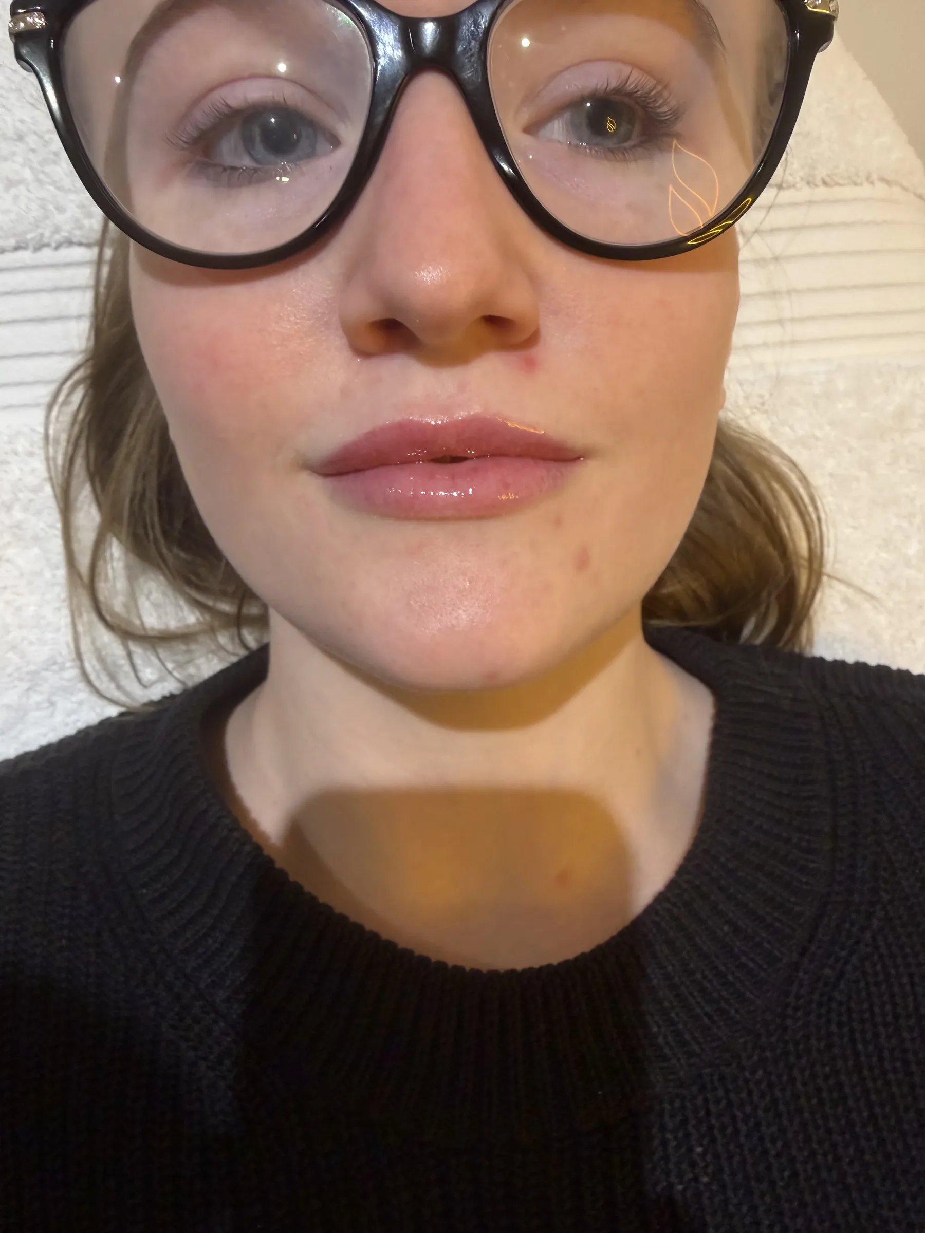 Core Aesthetics Oakleigh clinic facial ageing and anatomy assessment consultation figure 13 supporting Next Step and skin structure and movement ageing