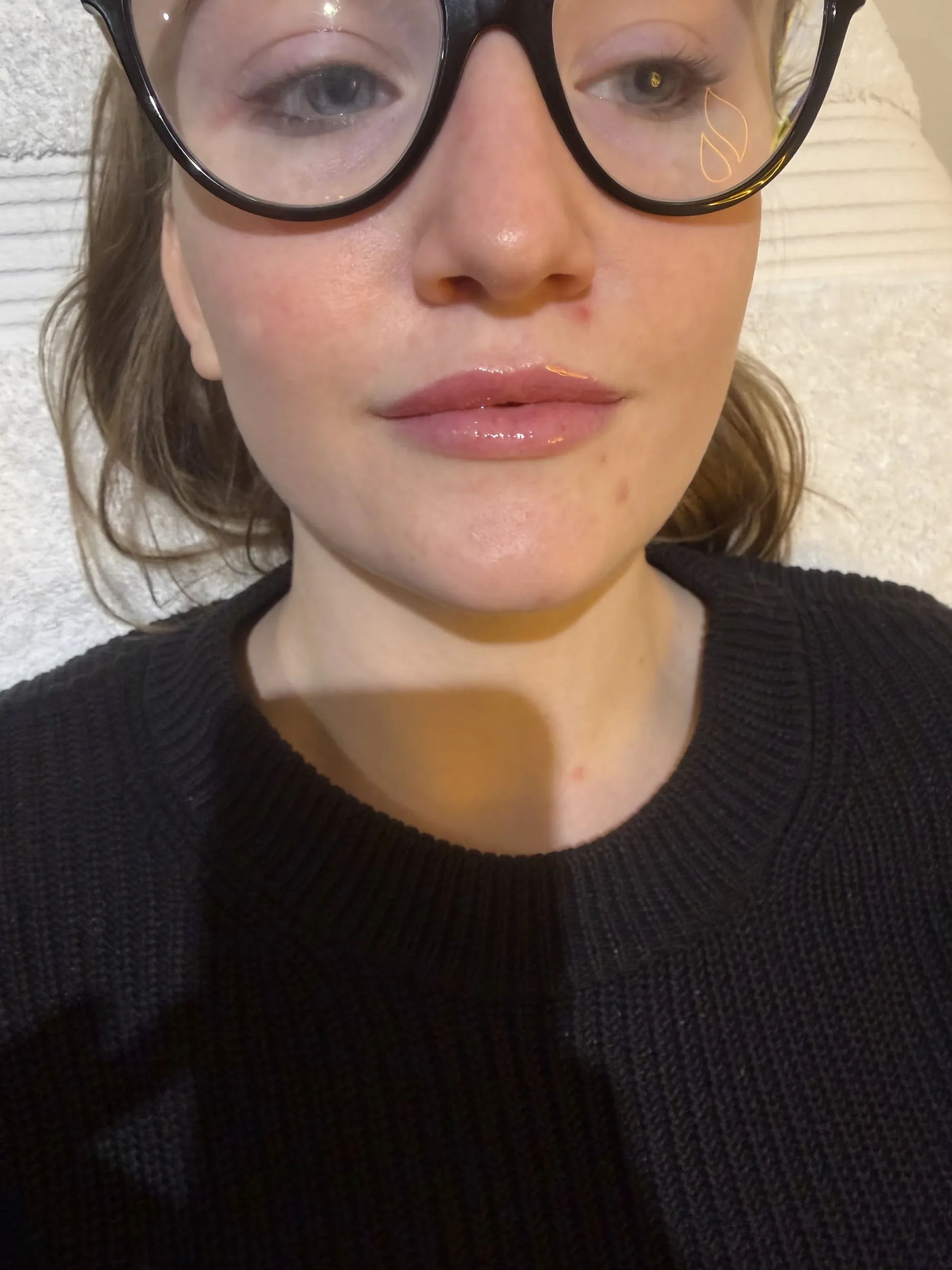 Core Aesthetics Oakleigh clinic facial ageing and anatomy assessment consultation figure 6 supporting Step Five: Know When Medical Review Comes First and next step for facial ageing