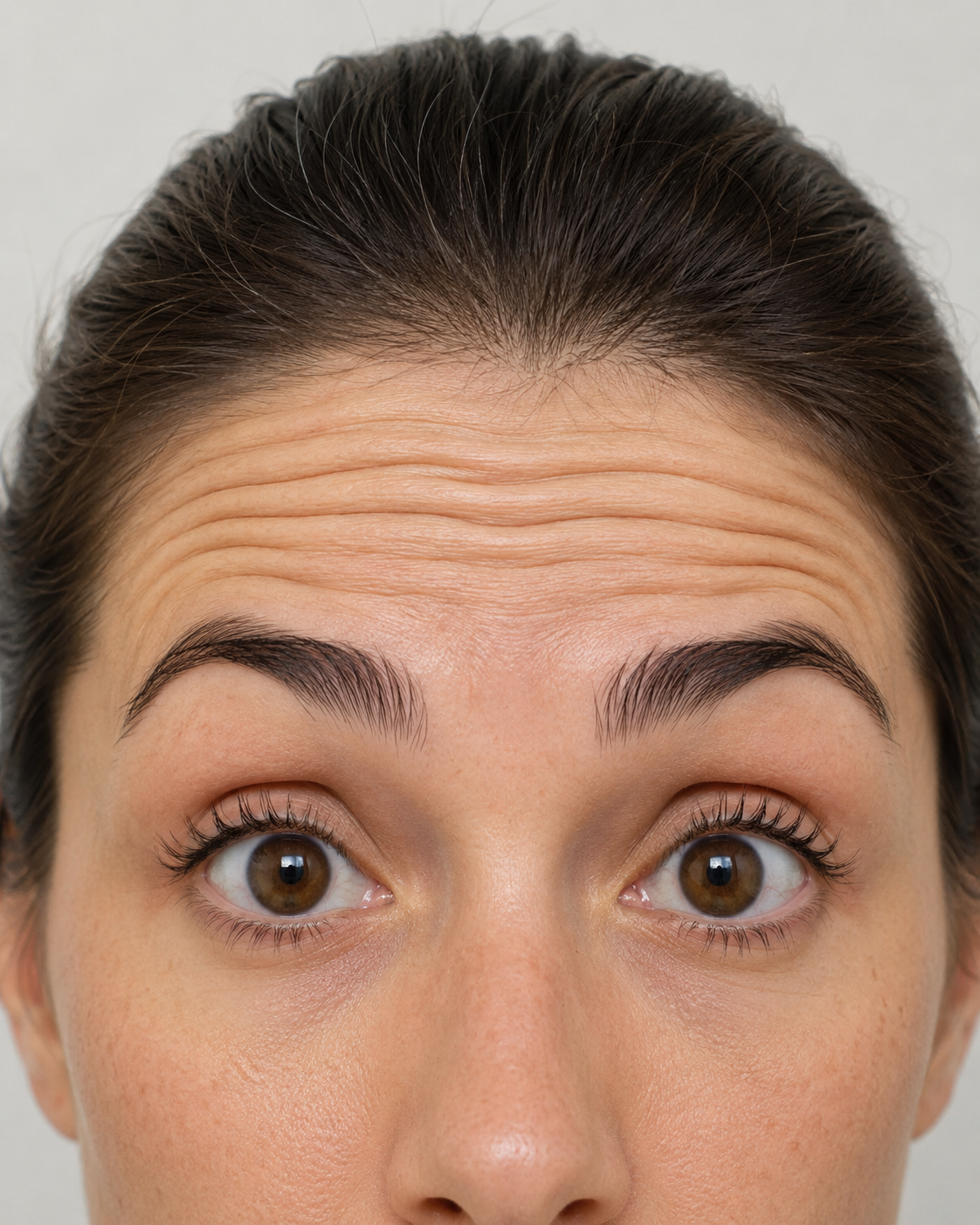 Wrinkle and upper-face consultation assessment for consultation planning at Core Aesthetics in Oakleigh