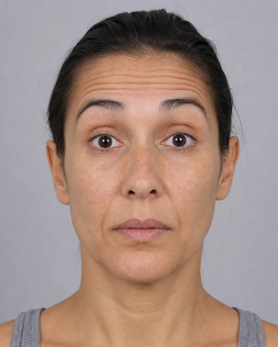 General educational upper face image for consultation context at Core Aesthetics in Oakleigh