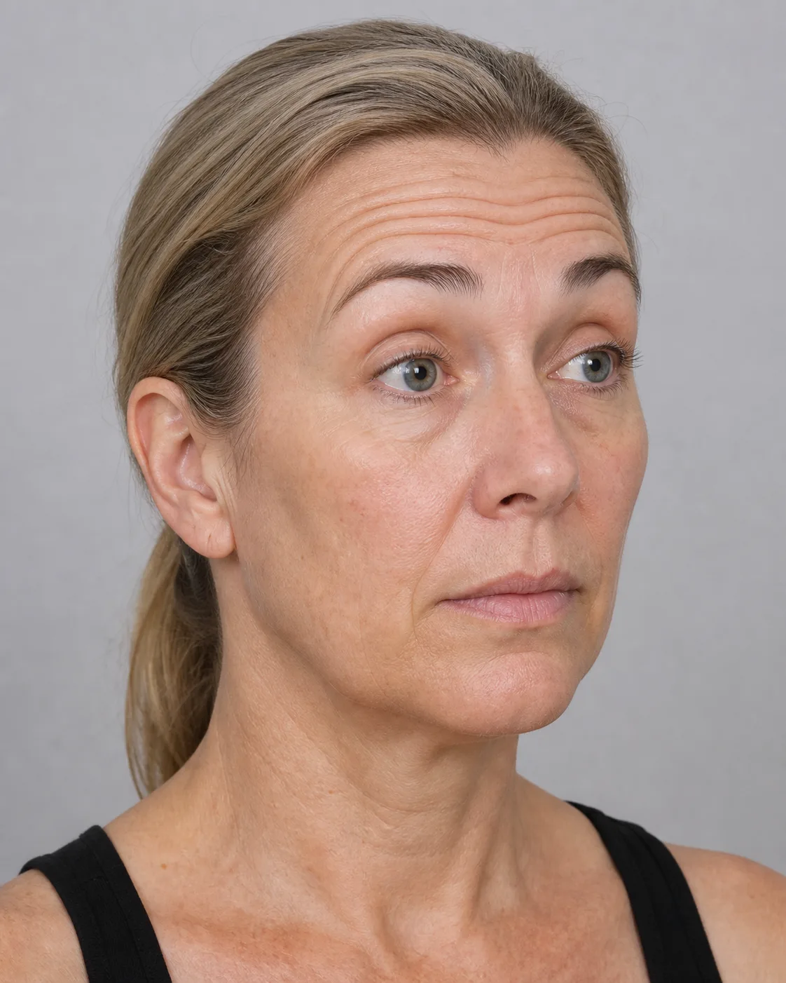 Three quarter upper face portrait for general information at Core Aesthetics in Oakleigh