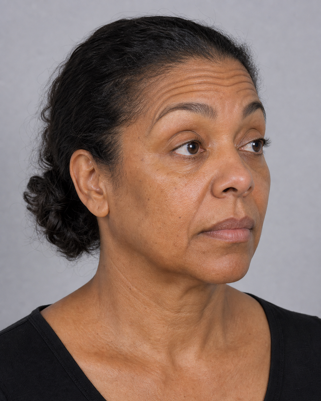 Wrinkle and upper-face consultation assessment for consultation planning at Core Aesthetics in Oakleigh