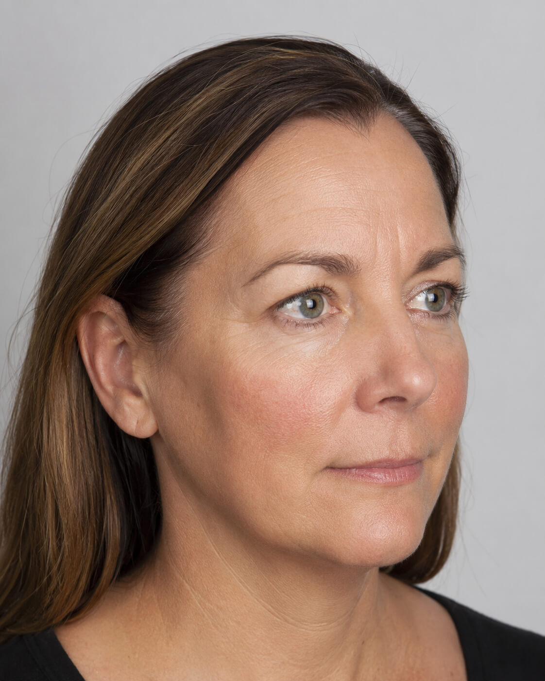 Facial ageing education and assessment context as an educational reference at Core Aesthetics in Oakleigh