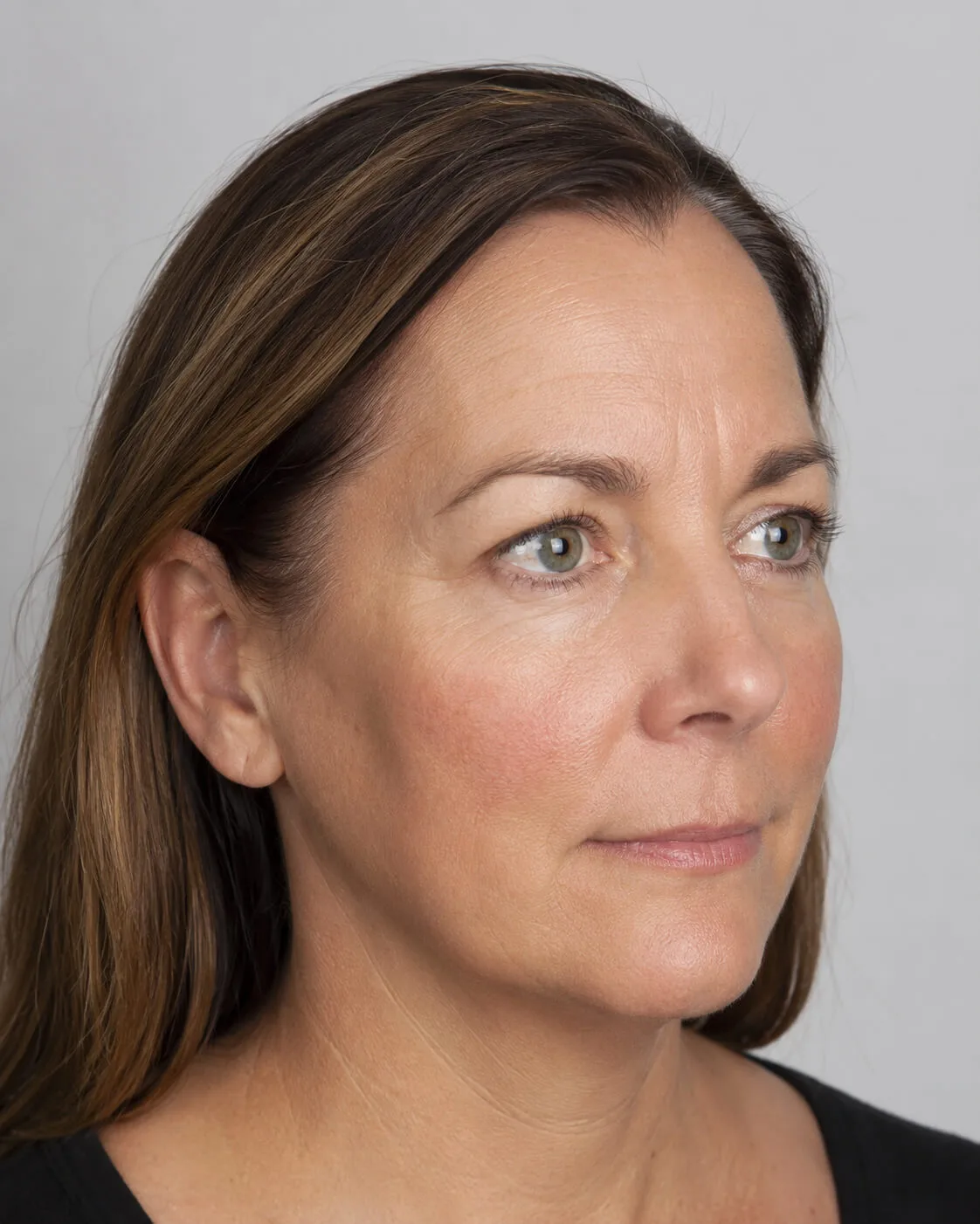 Facial ageing education and assessment context as an educational reference at Core Aesthetics in Oakleigh