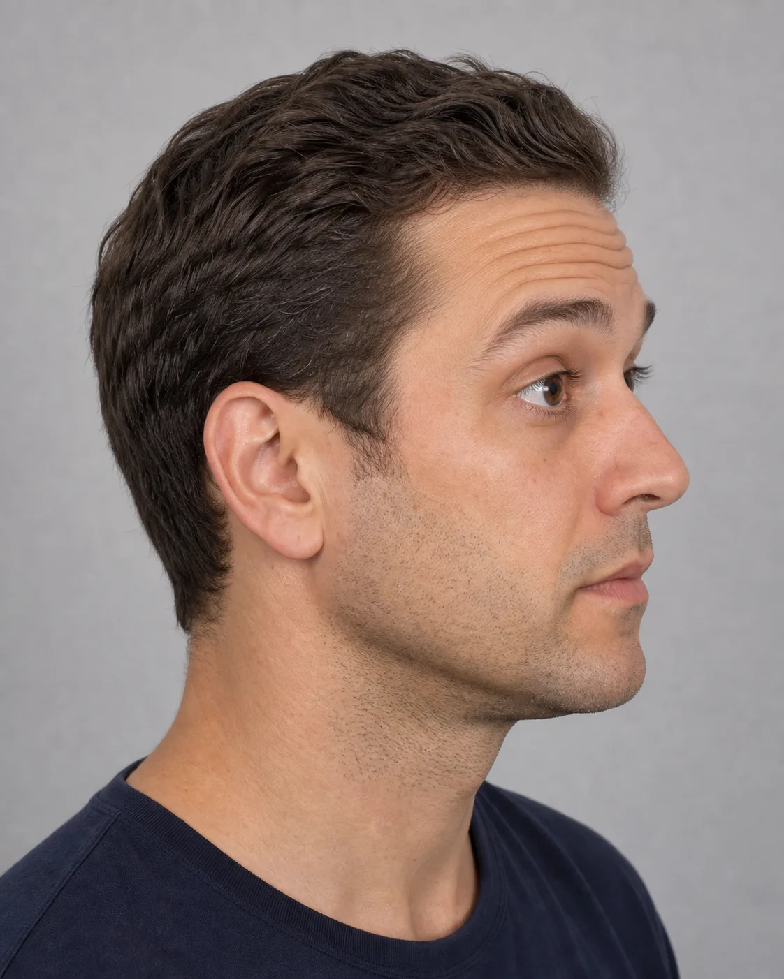 Wrinkle and upper-face consultation assessment for consultation planning at Core Aesthetics in Oakleigh